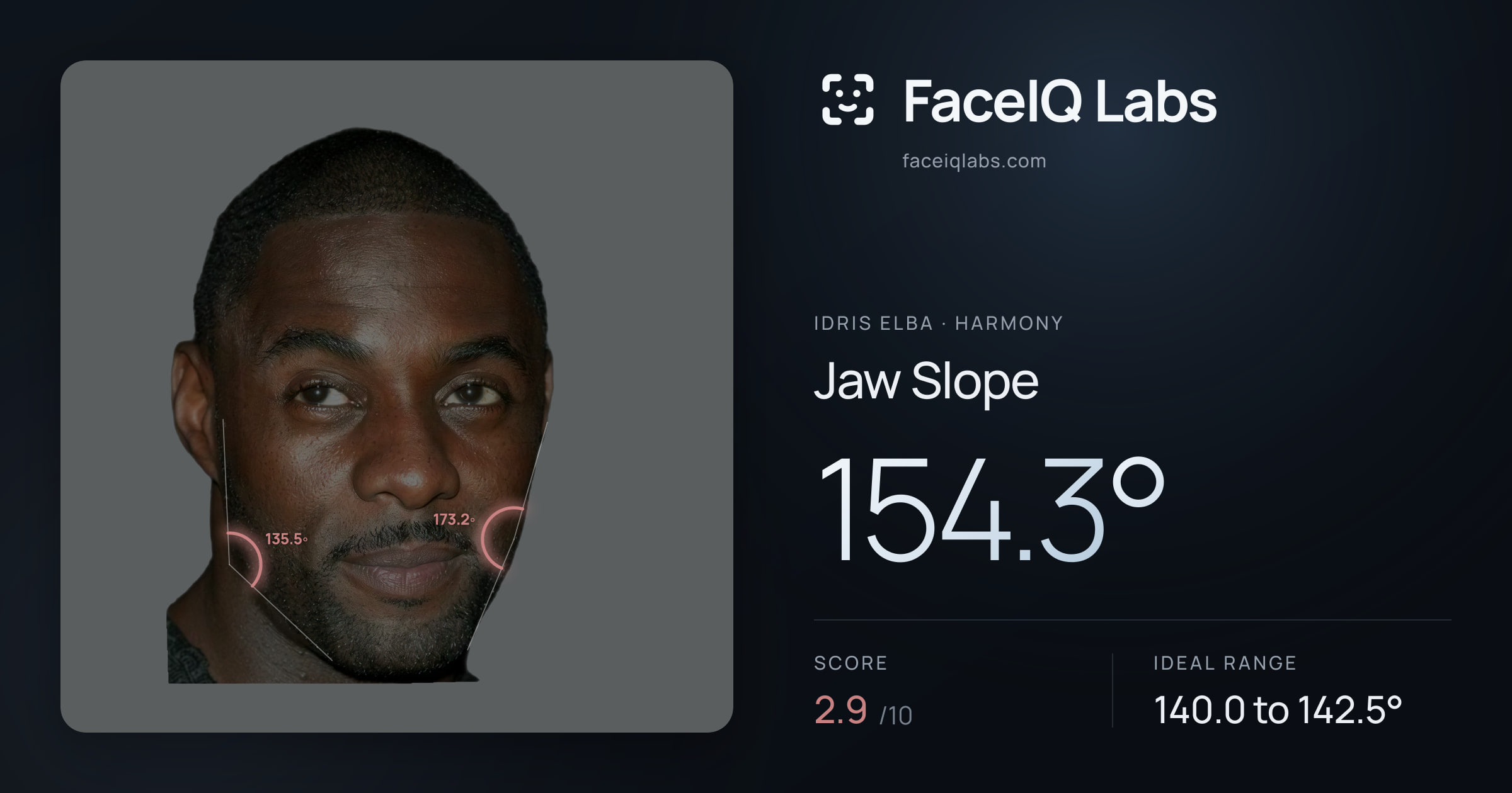 Idris Elba Jaw Slope: 154.3°, drawn on the photo