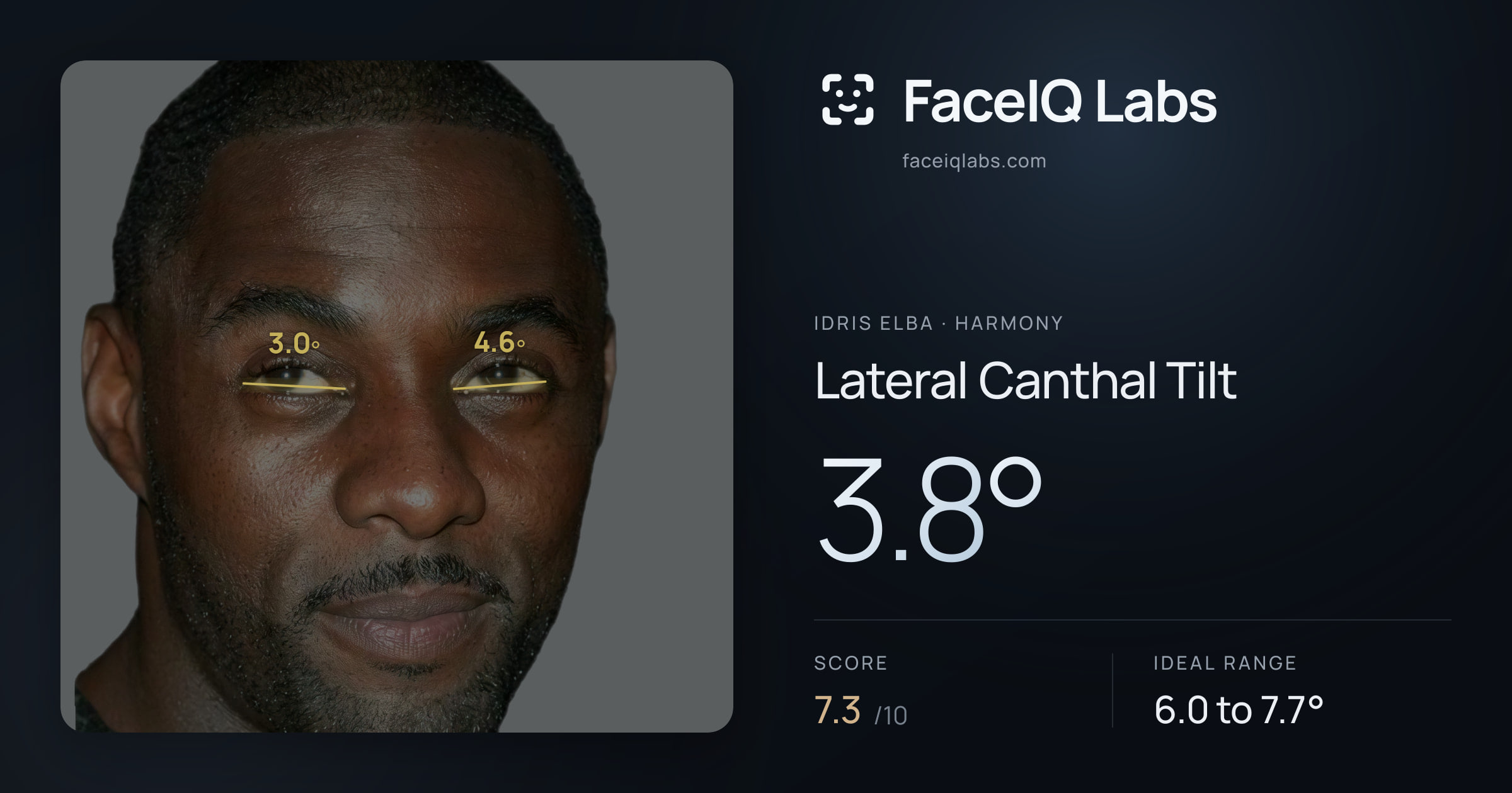 Idris Elba Lateral Canthal Tilt: 3.8°, drawn on the photo