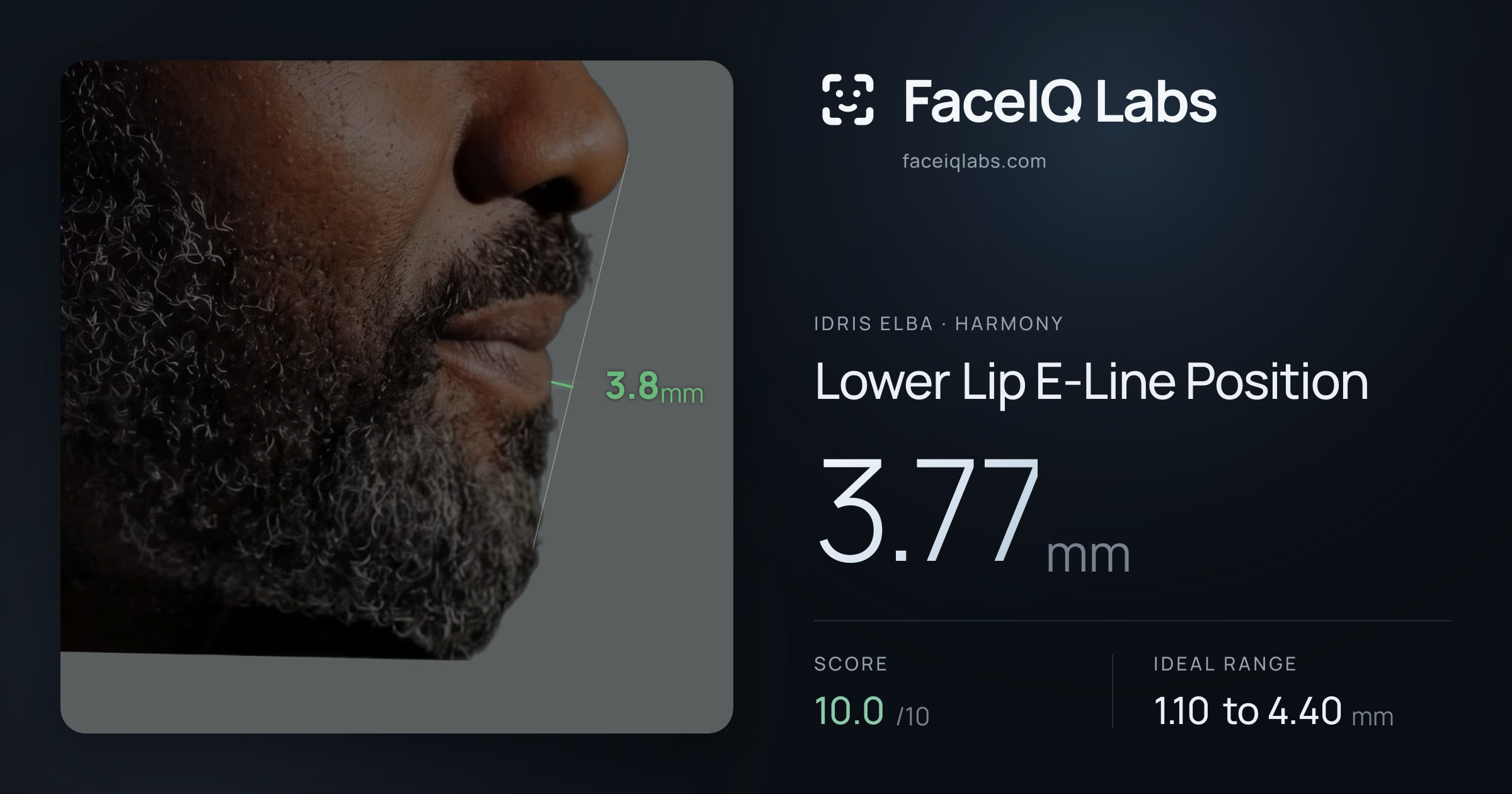 Idris Elba Lower Lip E-Line Position: 3.77mm, drawn on the photo