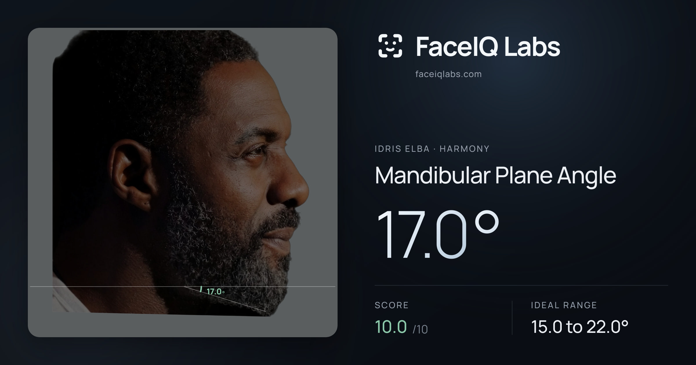 Idris Elba Mandibular Plane Angle: 17.0°, drawn on the photo