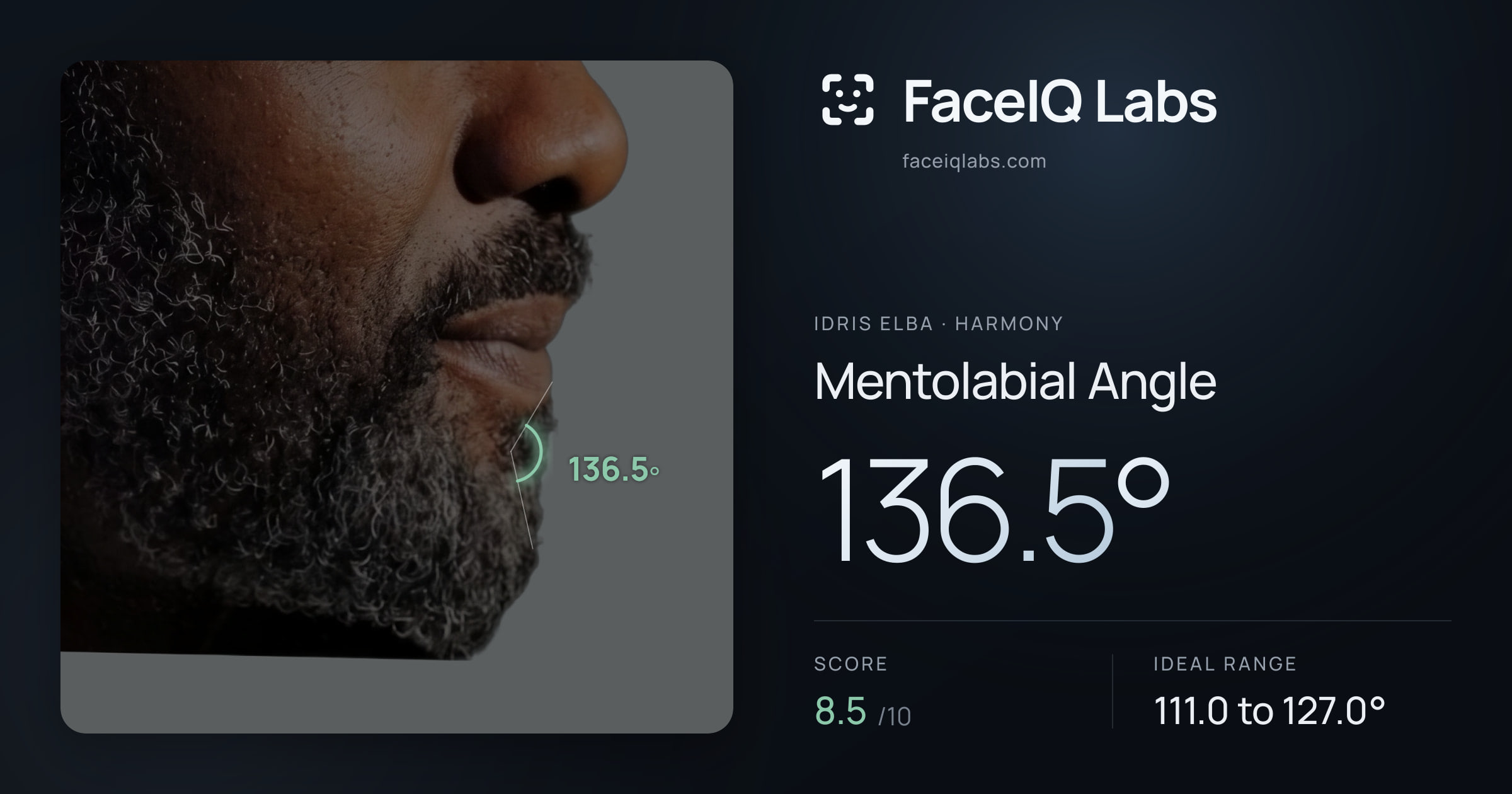 Idris Elba Mentolabial Angle: 136.5°, drawn on the photo