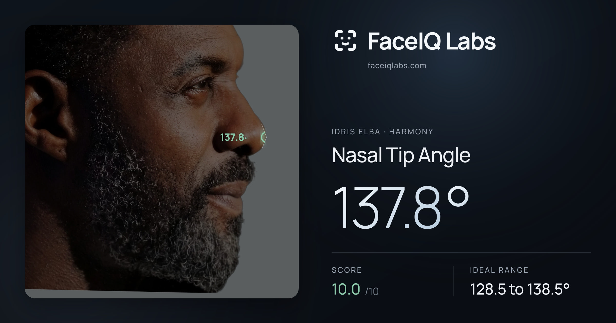 Idris Elba Nasal Tip Angle: 137.8°, drawn on the photo