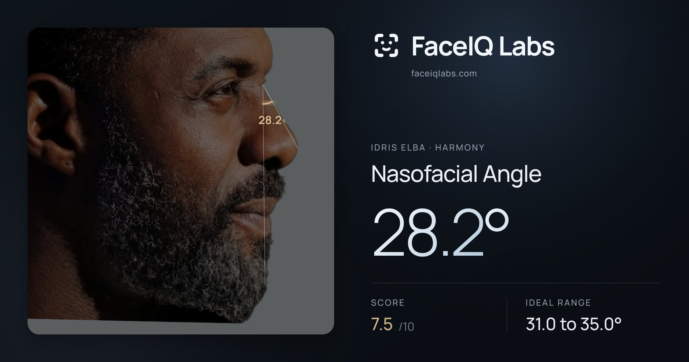 Idris Elba Nasofacial Angle: 28.2°, drawn on the photo