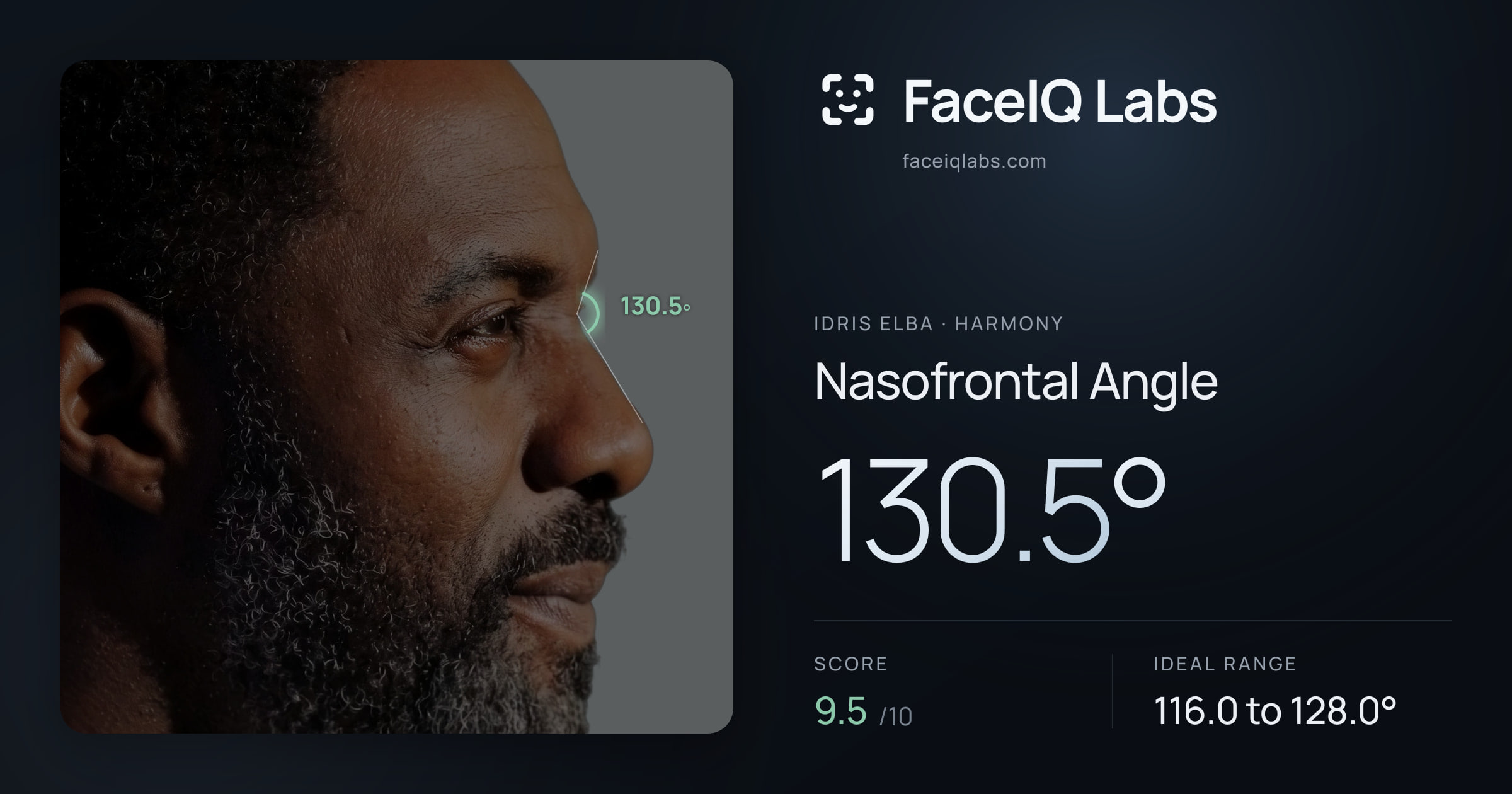 Idris Elba Nasofrontal Angle: 130.5°, drawn on the photo