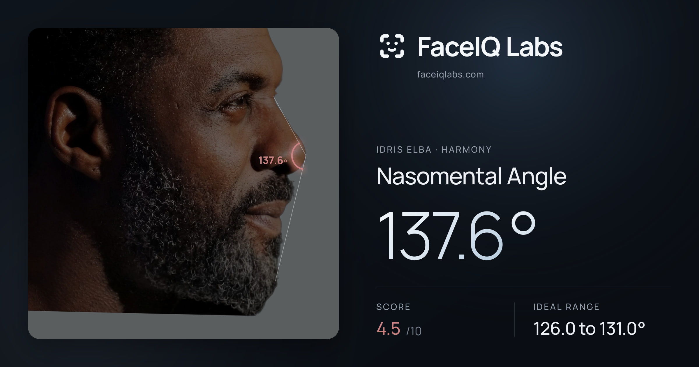 Idris Elba Nasomental Angle: 137.6°, drawn on the photo