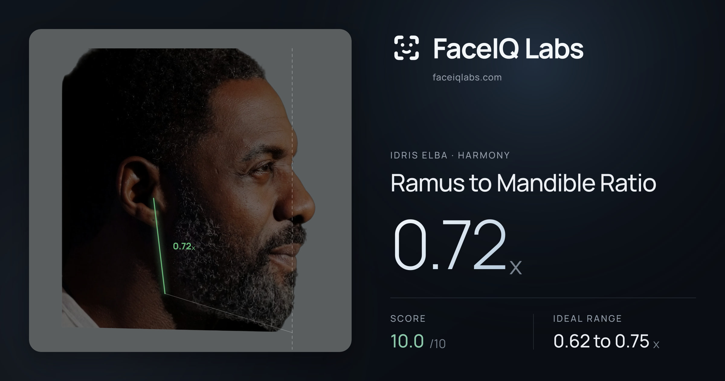 Idris Elba Ramus to Mandible Ratio: 0.72x, drawn on the photo