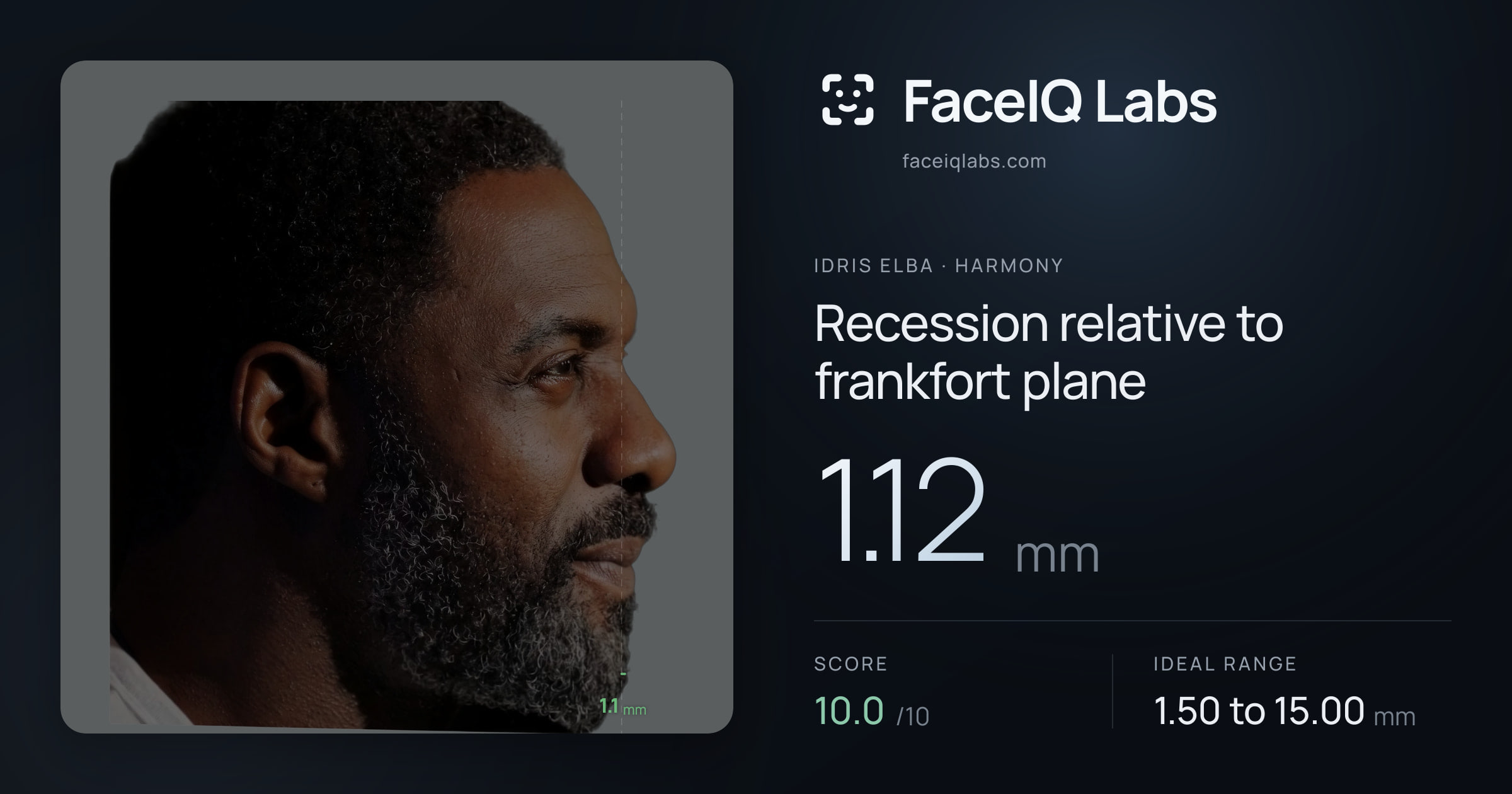 Idris Elba Recession relative to frankfort plane: 1.12mm, drawn on the photo