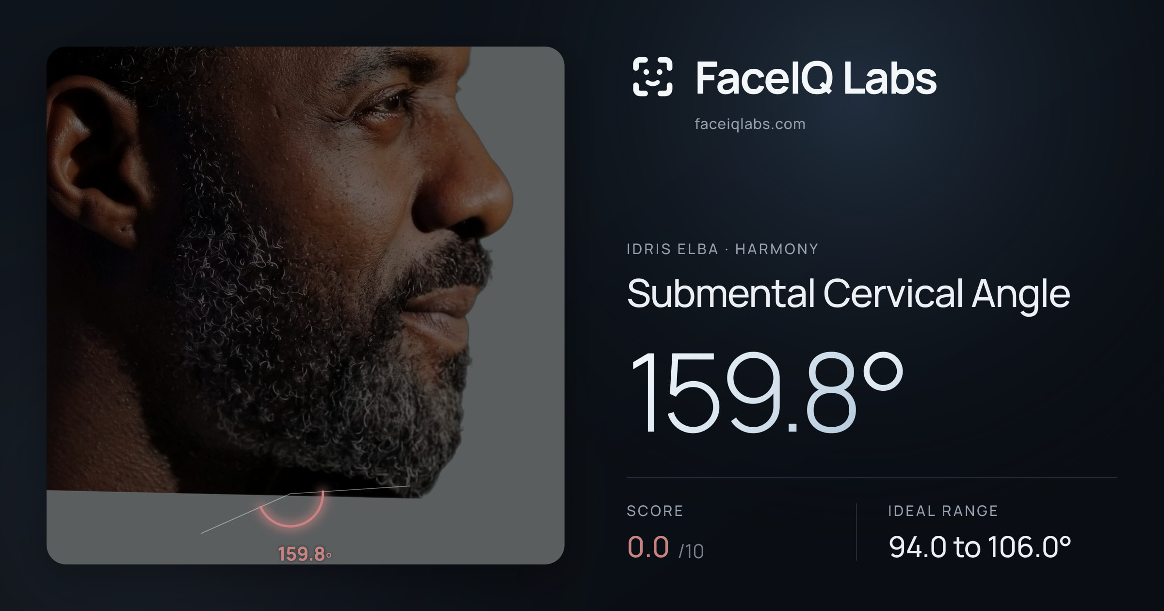 Idris Elba Submental Cervical Angle: 159.8°, drawn on the photo