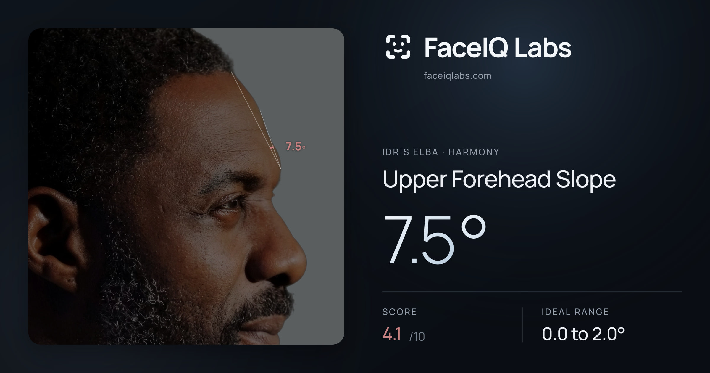 Idris Elba Upper Forehead Slope: 7.5°, drawn on the photo