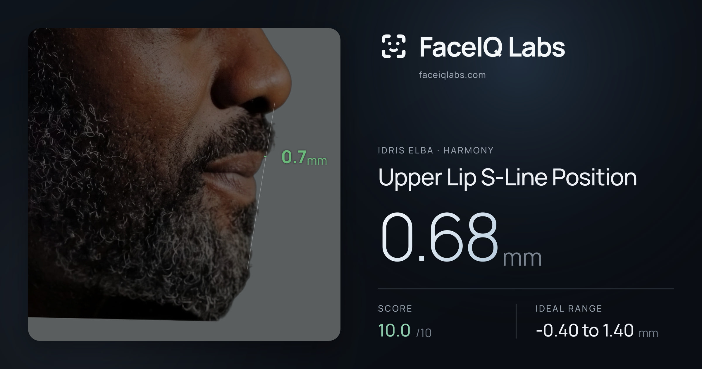 Idris Elba Upper Lip S-Line Position: 0.68mm, drawn on the photo