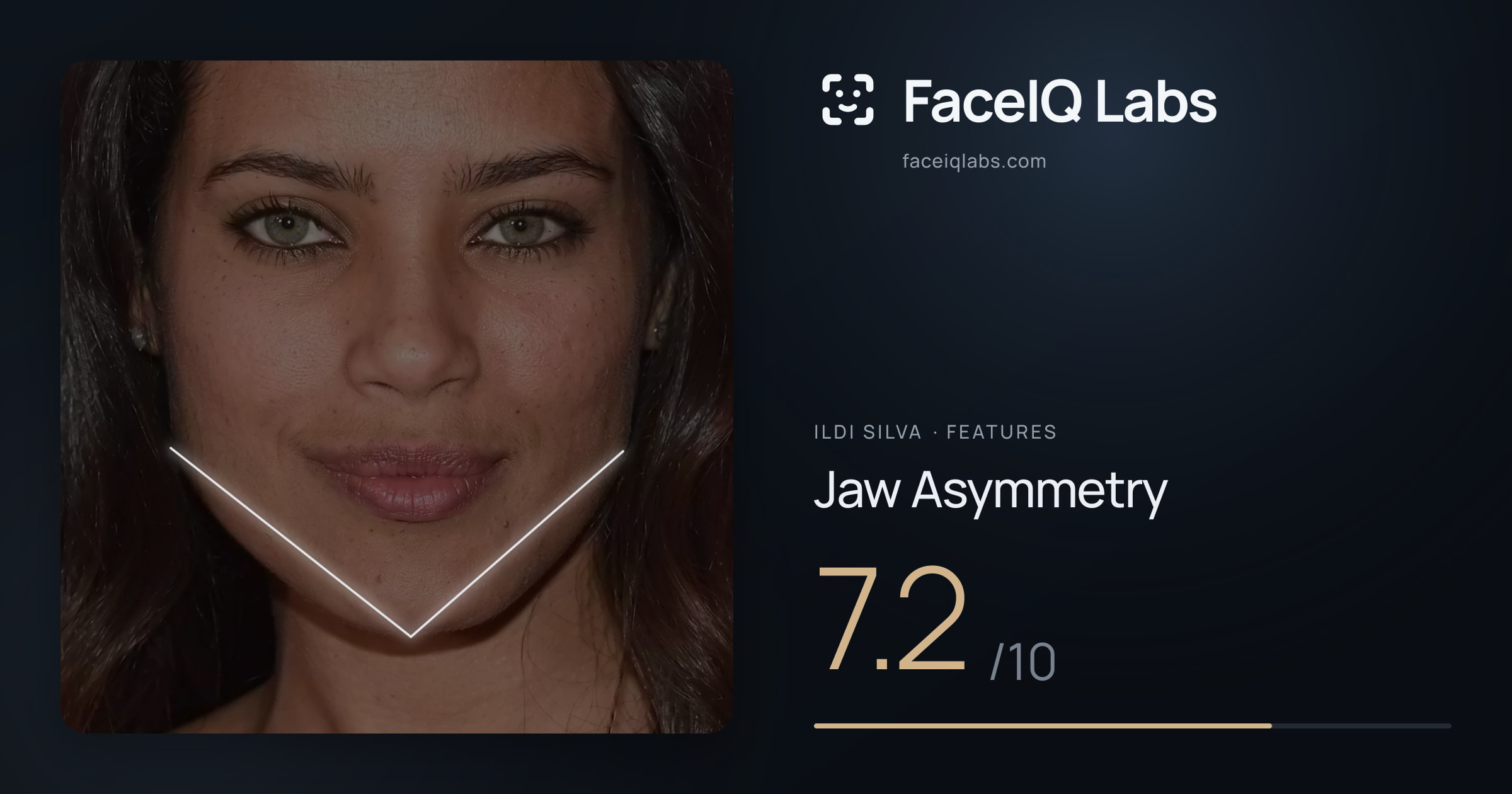 Ildi Silva Jaw Asymmetry: 7.2/10, drawn on the photo