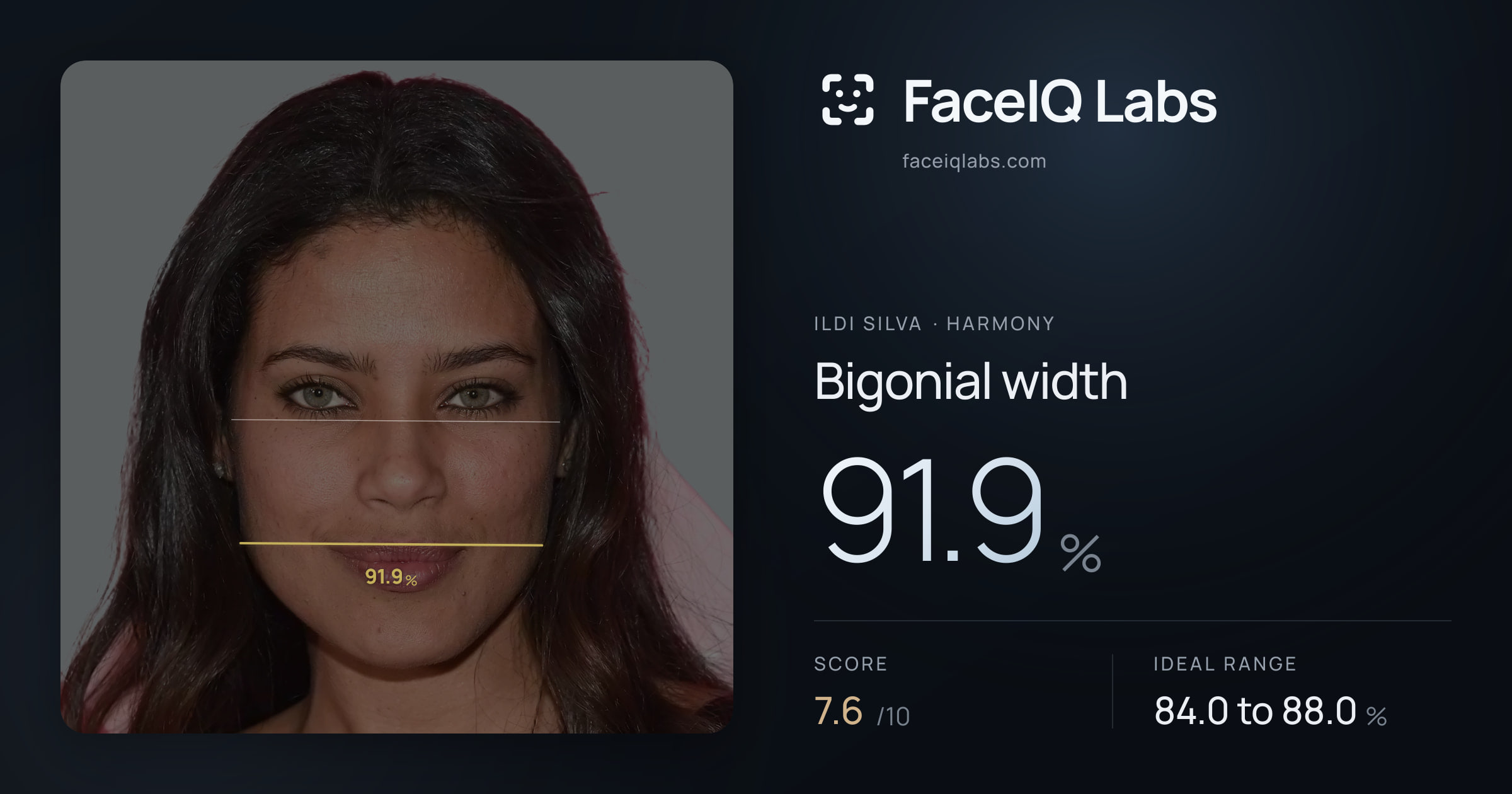 Ildi Silva Bigonial width: 91.9%, drawn on the photo