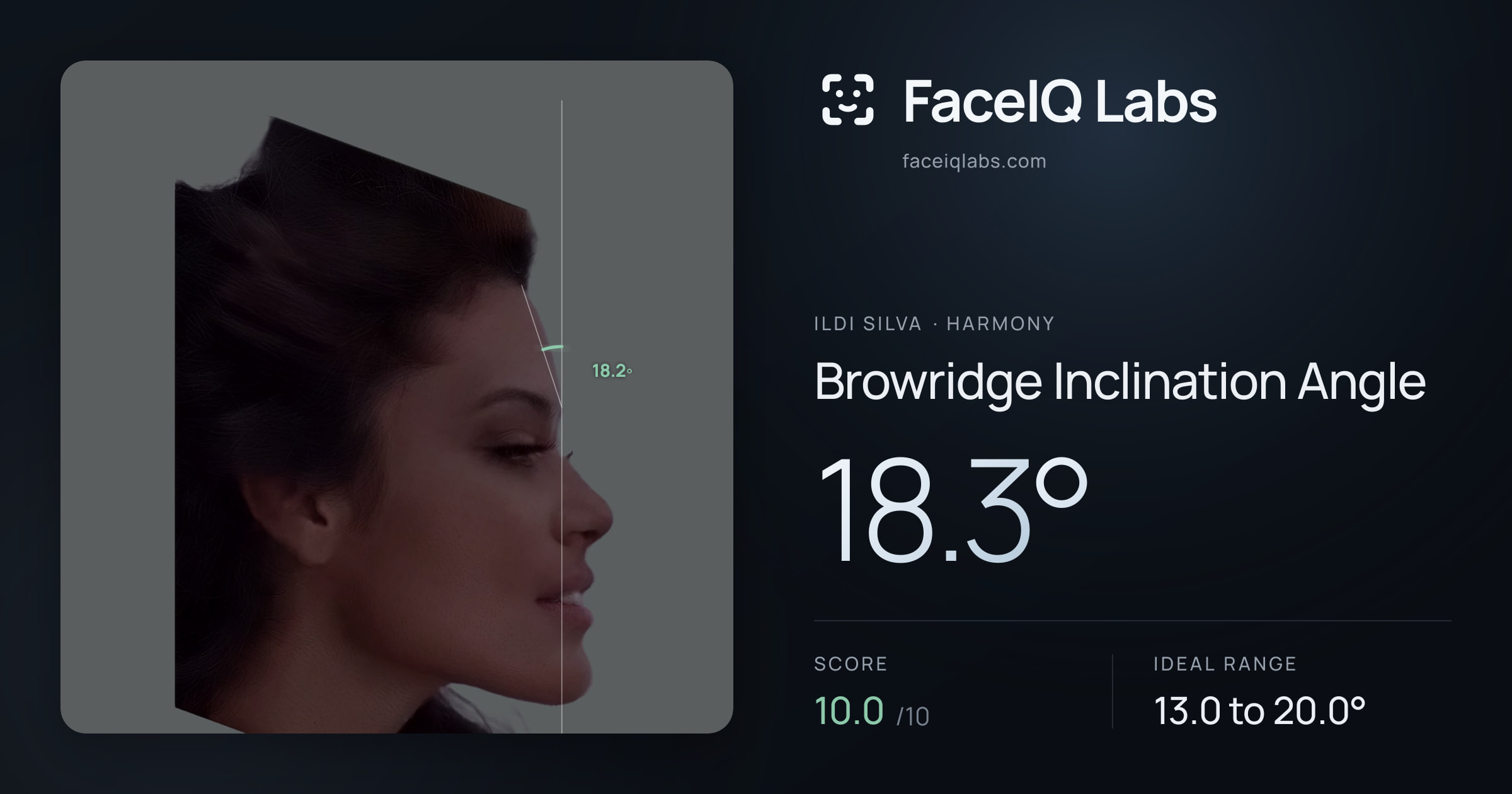 Ildi Silva Browridge Inclination Angle: 18.3°, drawn on the photo