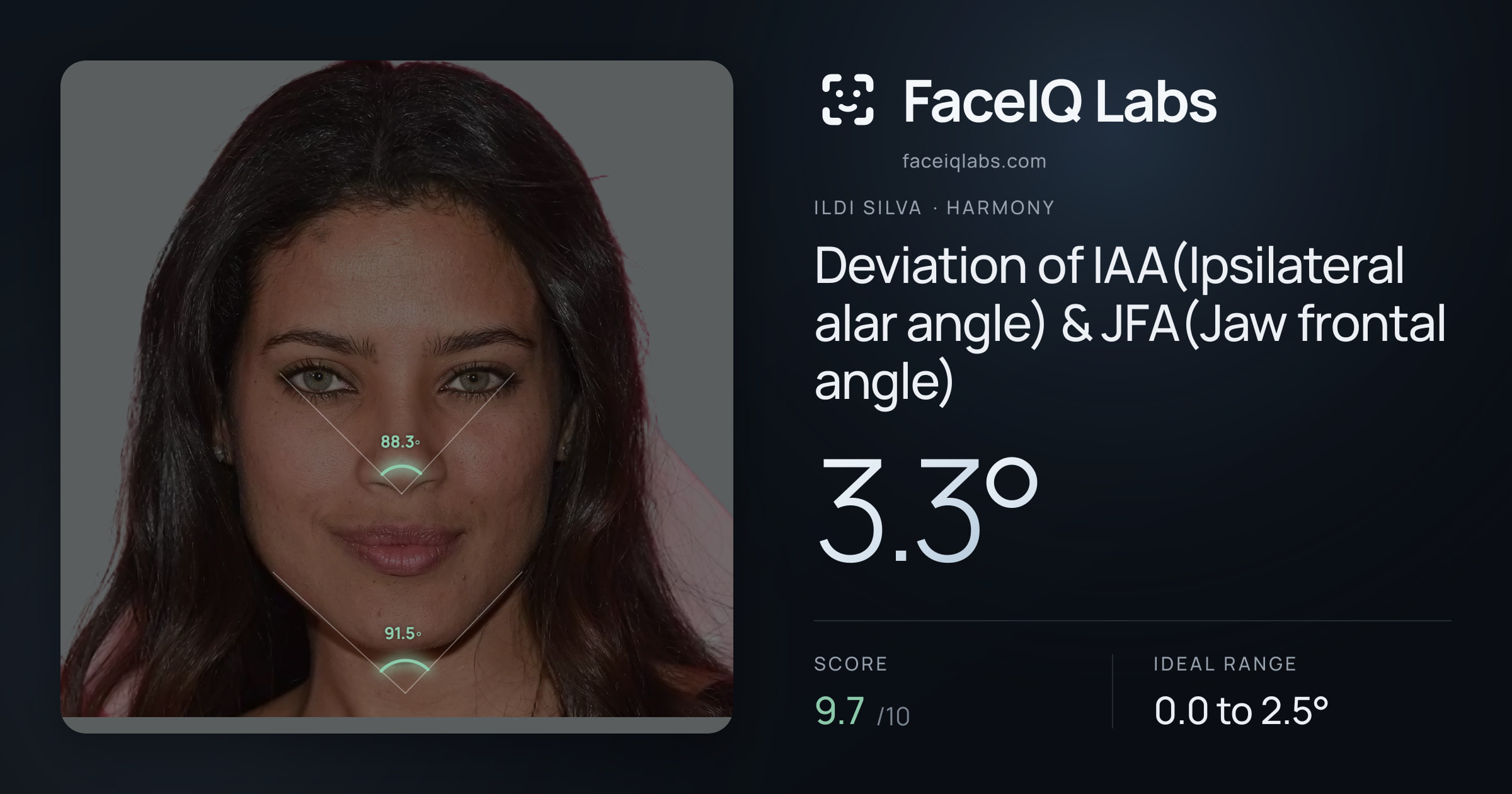 Ildi Silva Deviation of IAA(Ipsilateral alar angle) & JFA(Jaw frontal angle): 3.3°, drawn on the photo