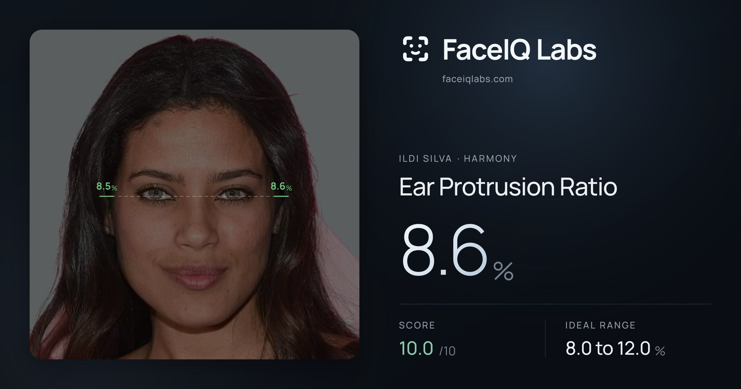Ildi Silva Ear Protrusion Ratio: 8.6%, drawn on the photo