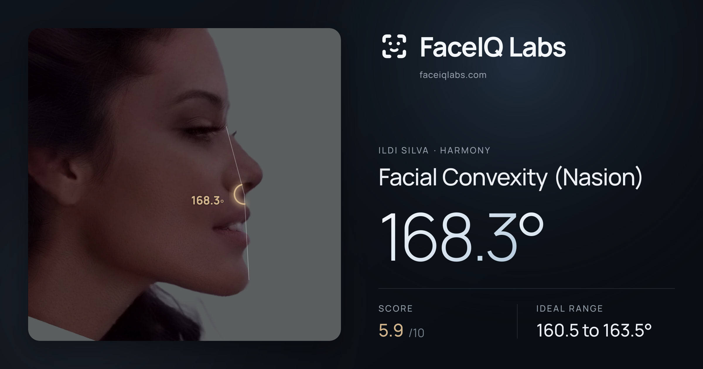 Ildi Silva Facial Convexity (Nasion): 168.3°, drawn on the photo