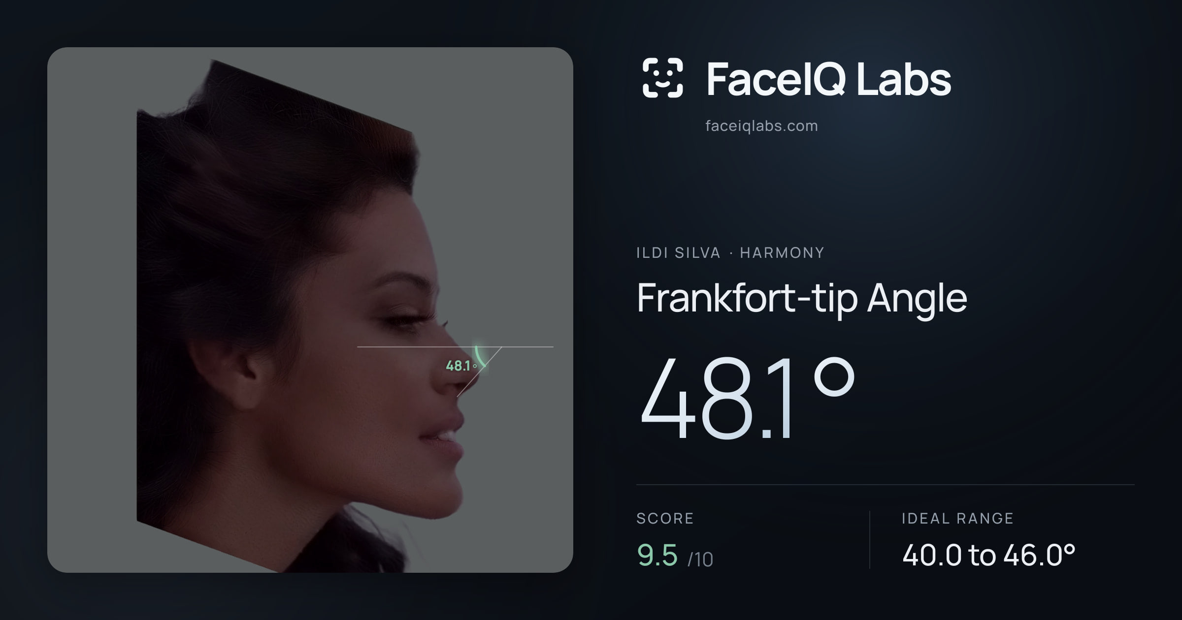 Ildi Silva Frankfort-tip Angle: 48.1°, drawn on the photo