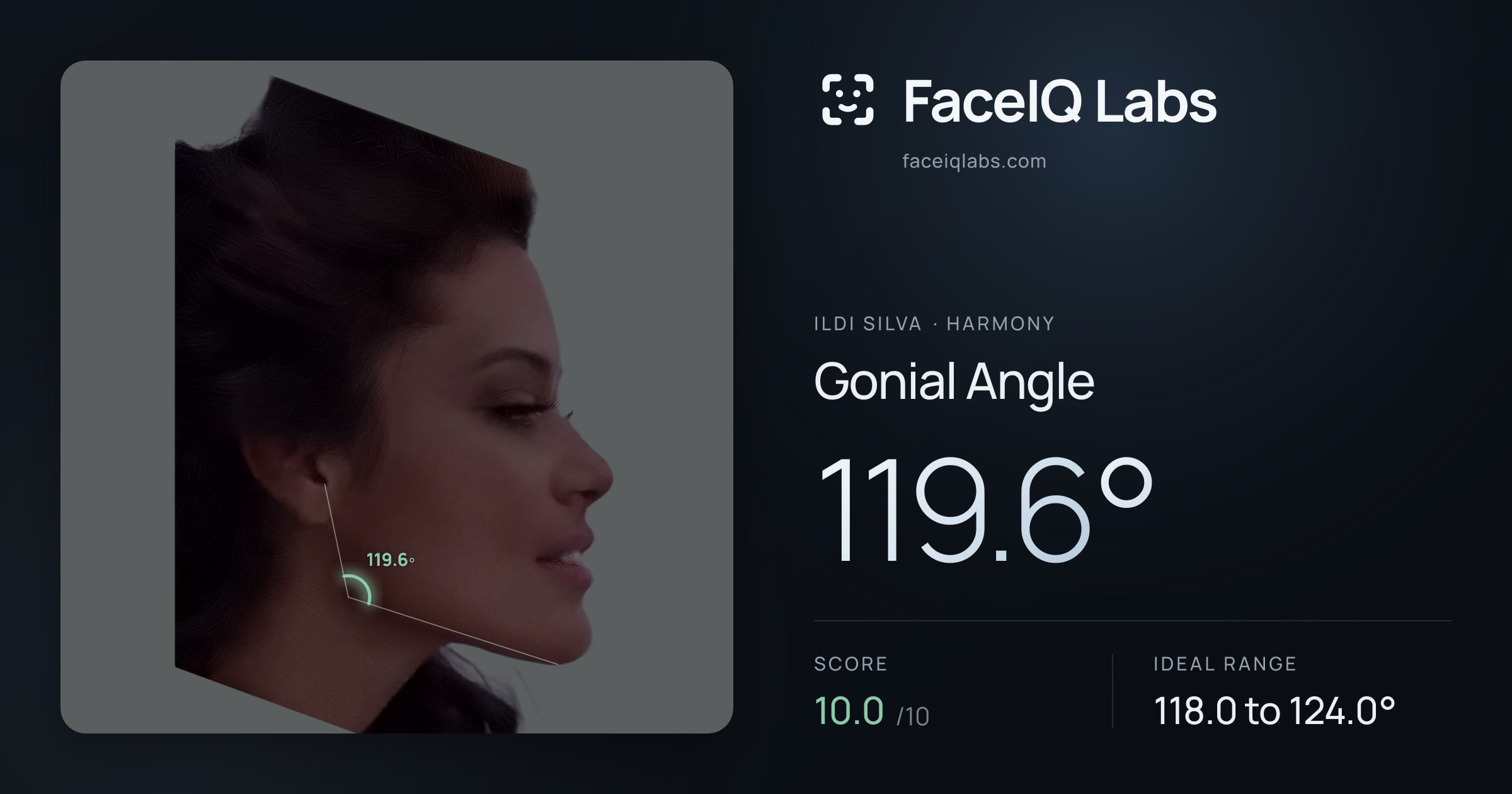 Ildi Silva Gonial Angle: 119.6°, drawn on the photo