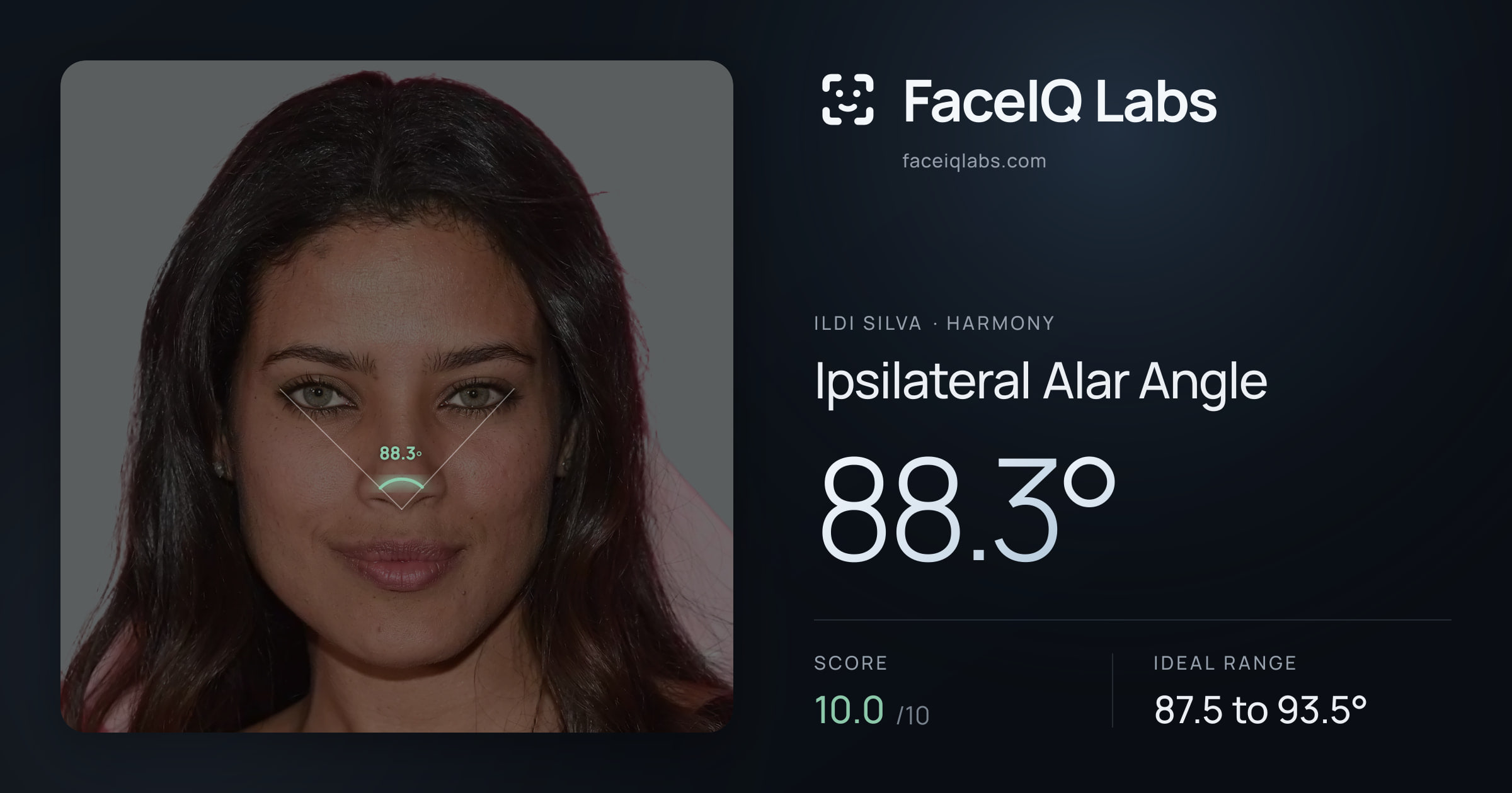 Ildi Silva Ipsilateral Alar Angle: 88.3°, drawn on the photo