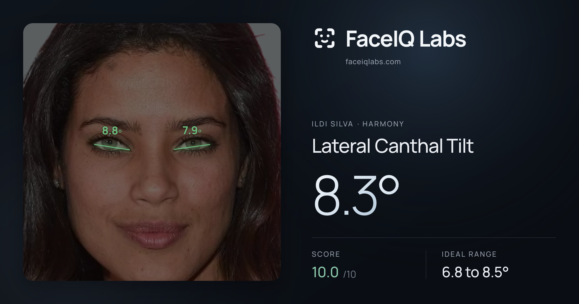 Ildi Silva Lateral Canthal Tilt: 8.3°, drawn on the photo
