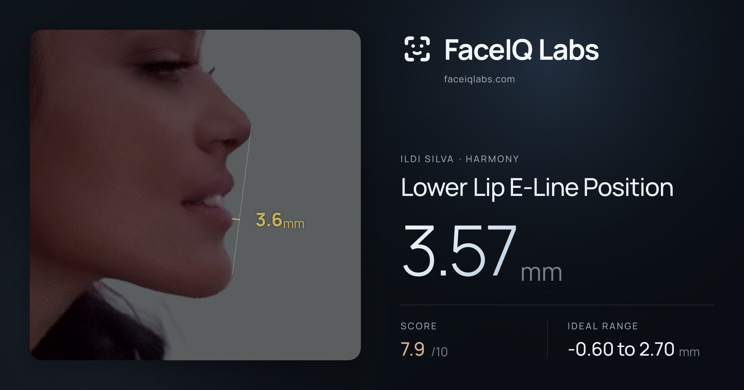 Ildi Silva Lower Lip E-Line Position: 3.57mm, drawn on the photo