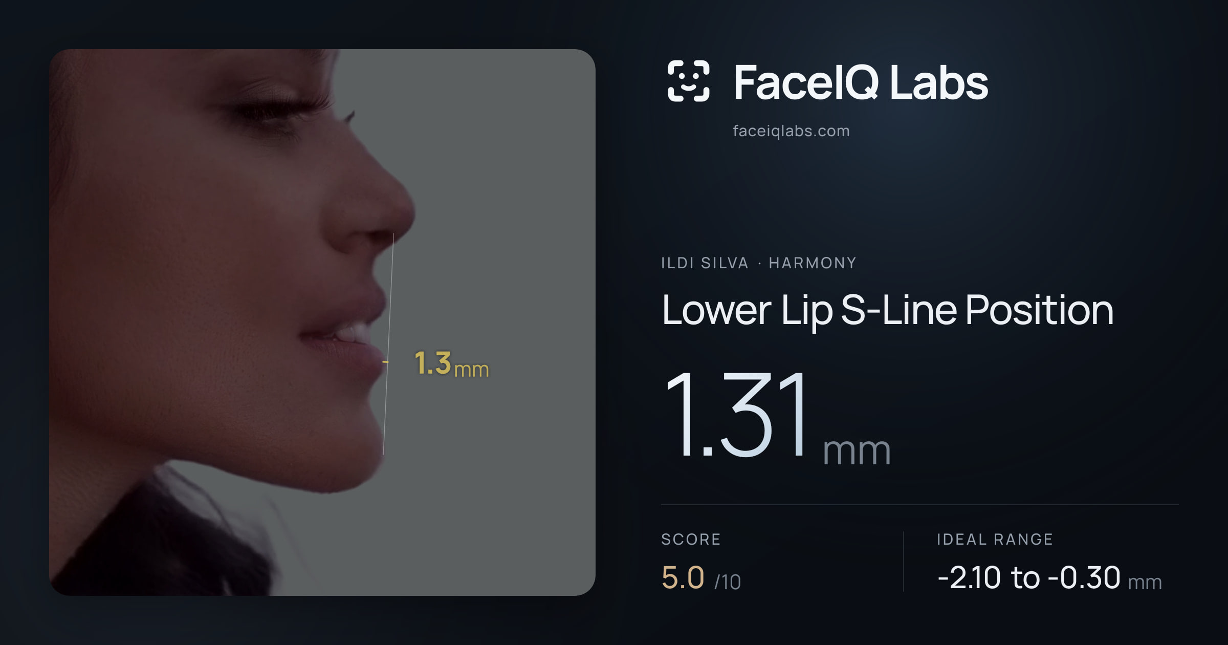 Ildi Silva Lower Lip S-Line Position: 1.31mm, drawn on the photo