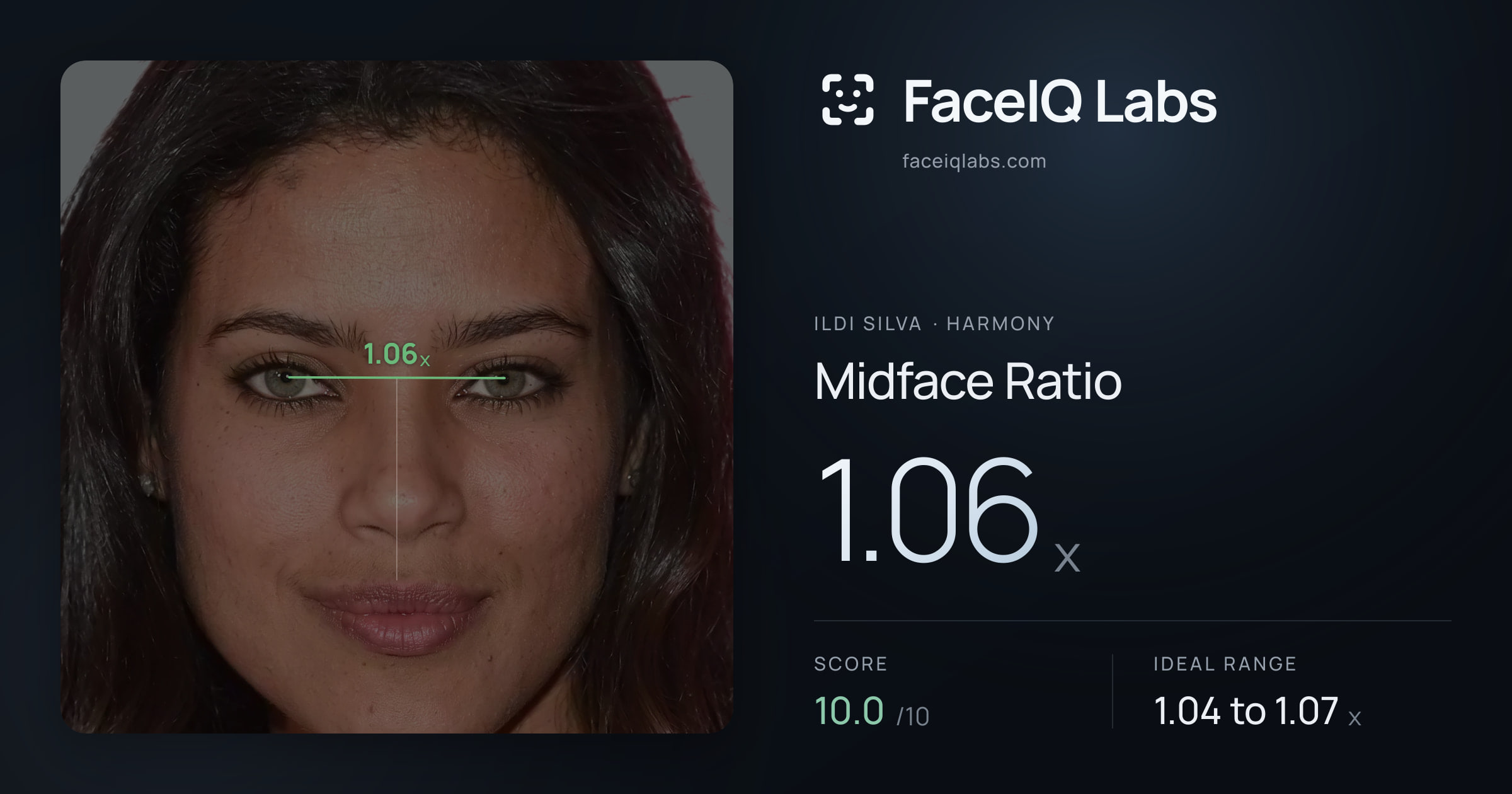 Ildi Silva Midface Ratio: 1.06x, drawn on the photo