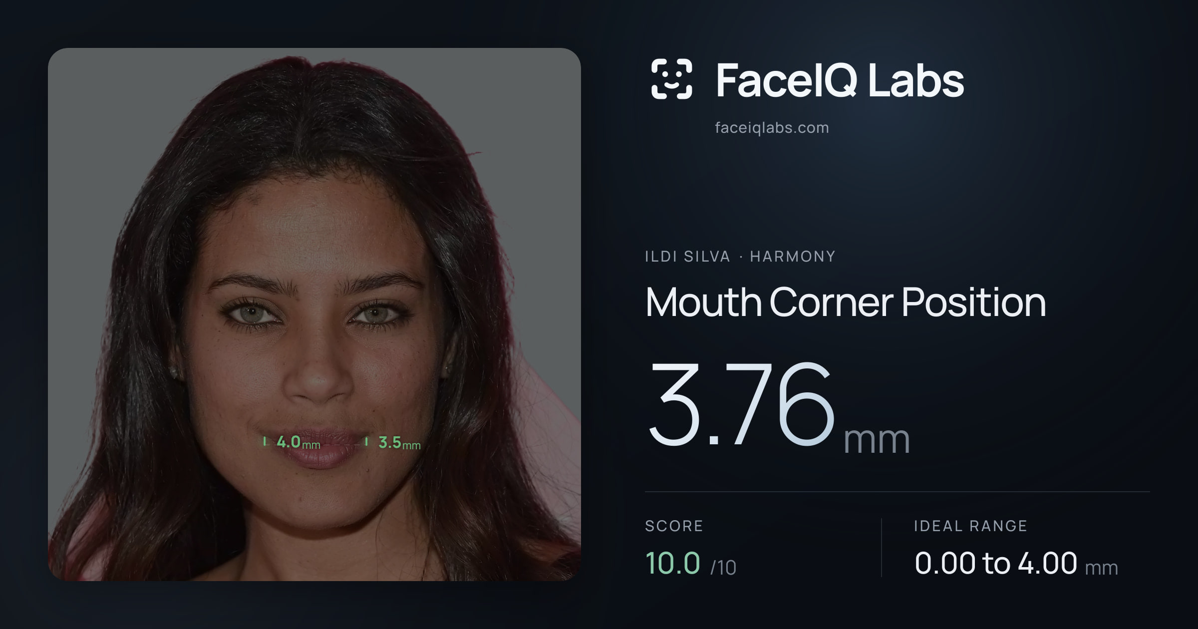 Ildi Silva Mouth Corner Position: 3.76mm, drawn on the photo