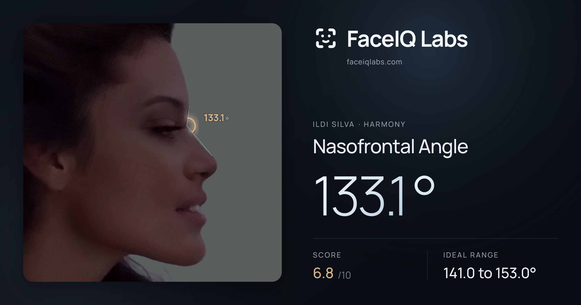Ildi Silva Nasofrontal Angle: 133.1°, drawn on the photo