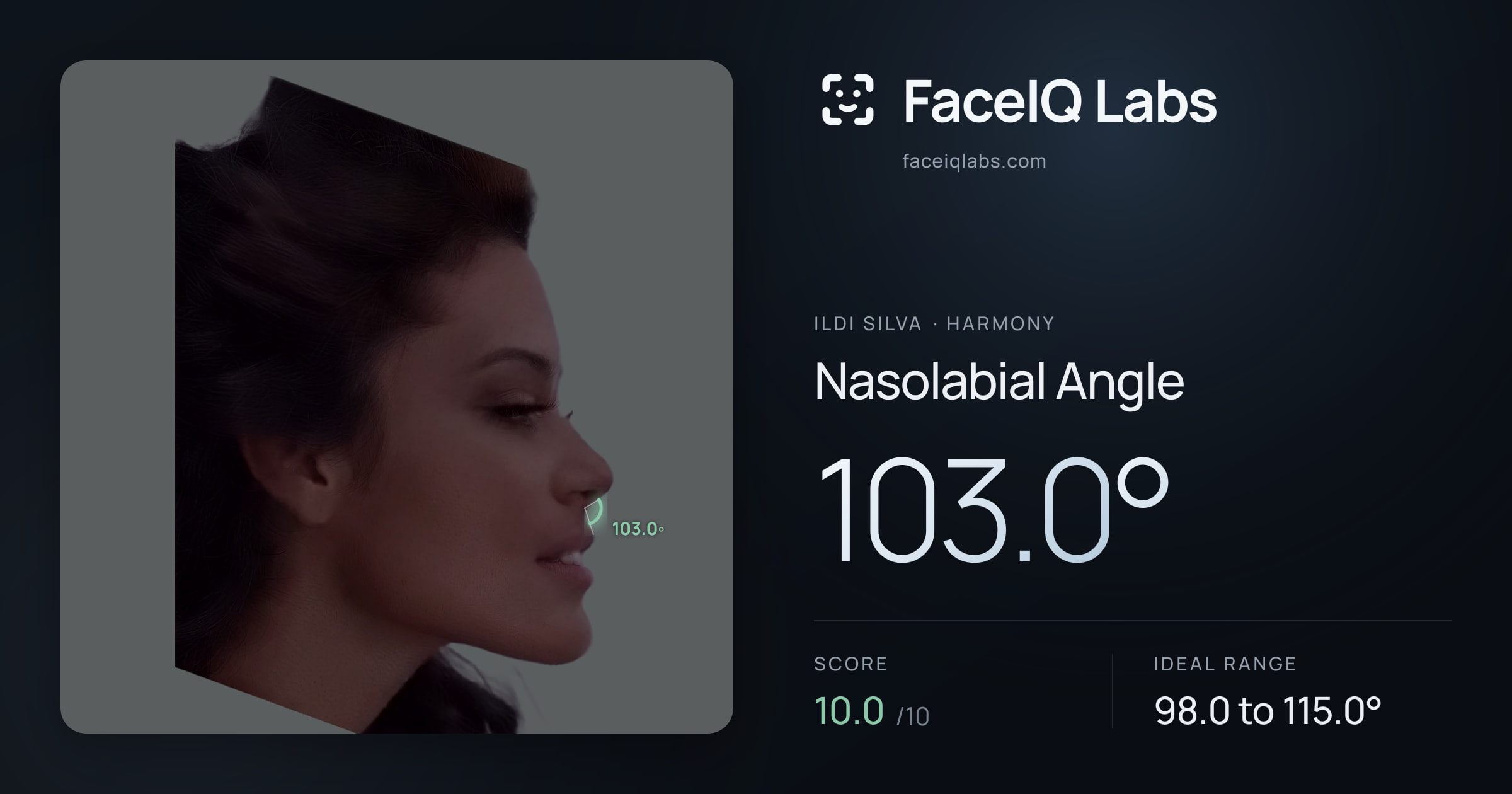 Ildi Silva Nasolabial Angle: 103.0°, drawn on the photo