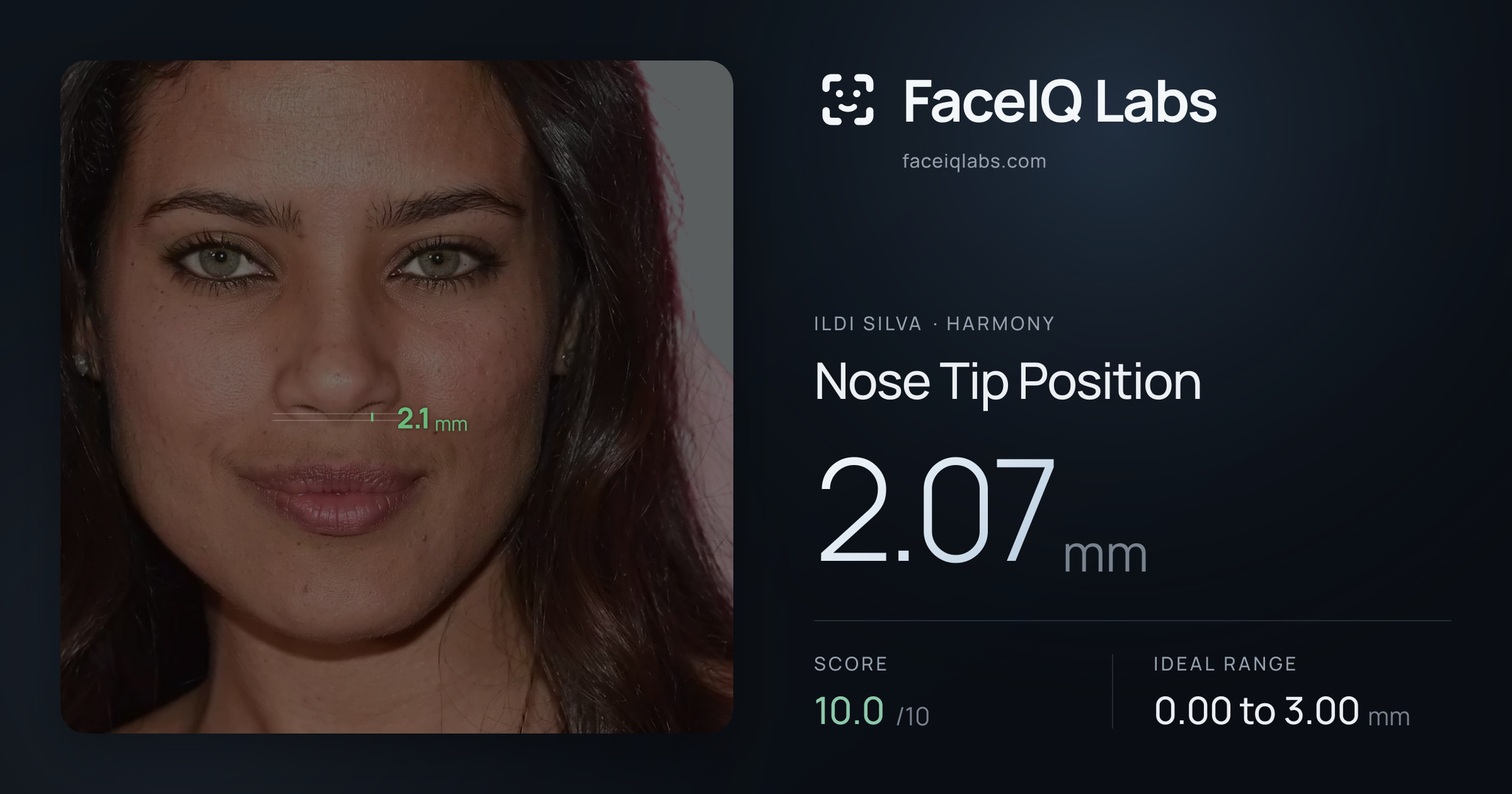 Ildi Silva Nose Tip Position: 2.07mm, drawn on the photo