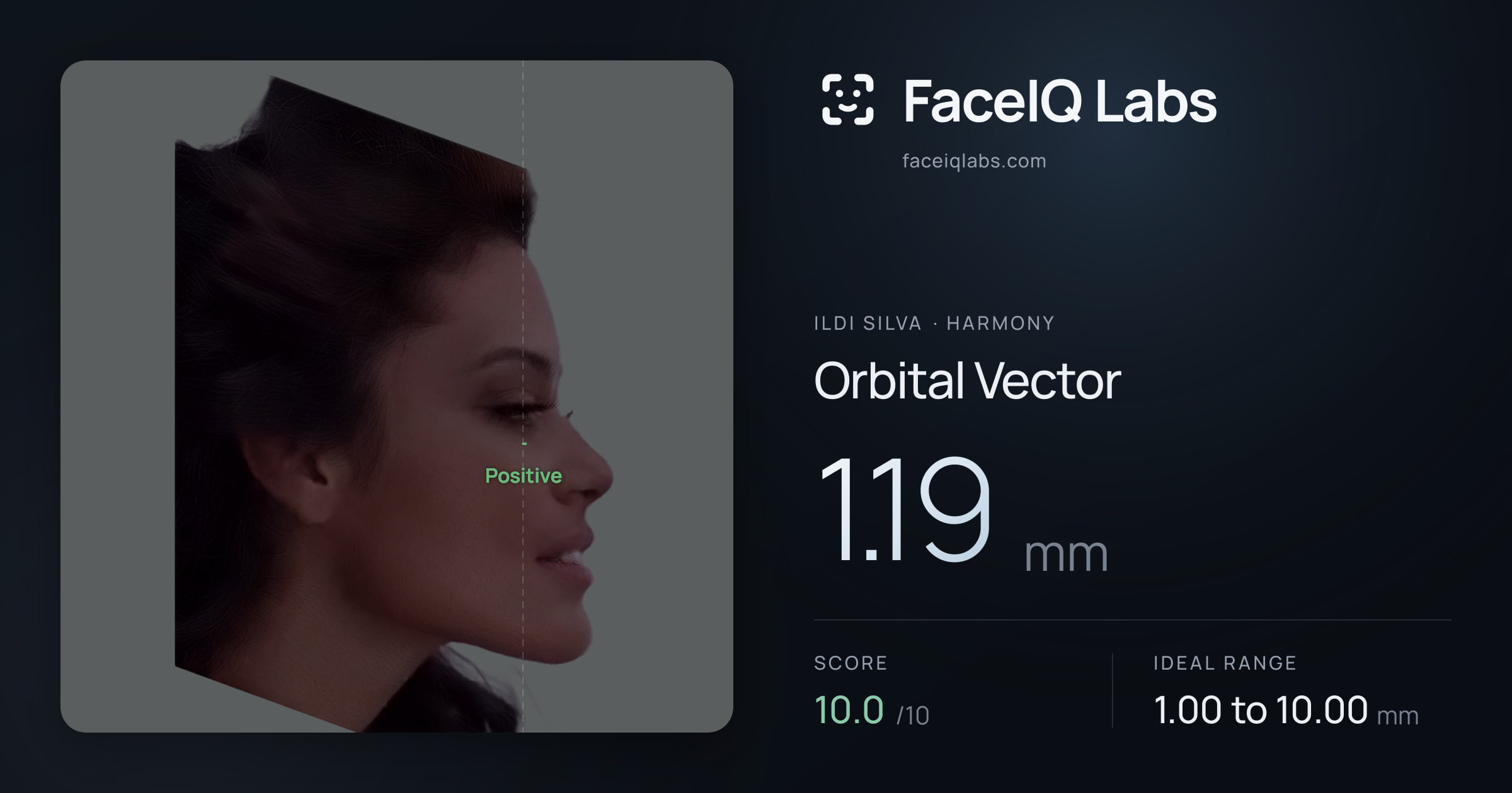 Ildi Silva Orbital Vector: 1.19mm, drawn on the photo