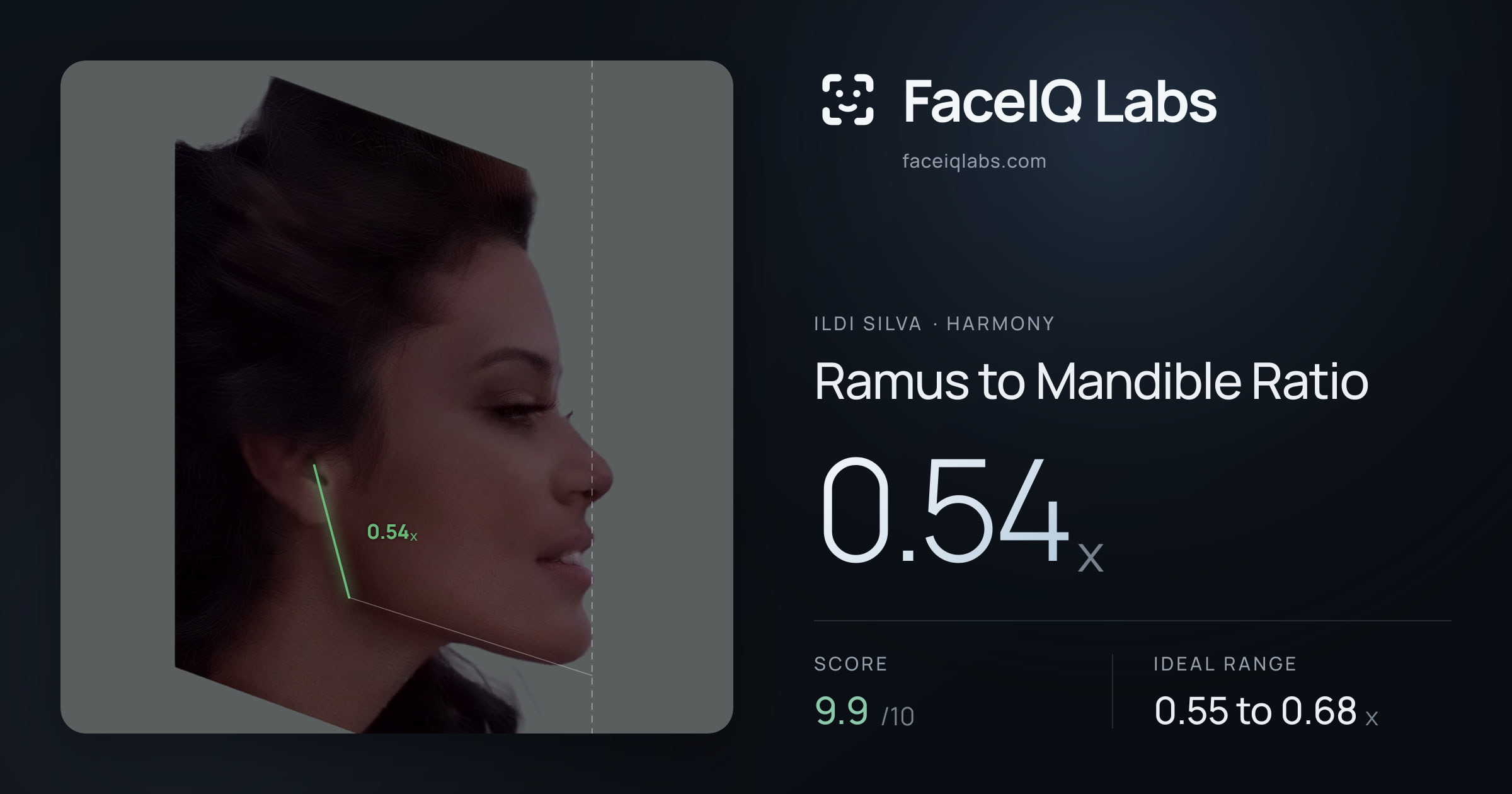 Ildi Silva Ramus to Mandible Ratio: 0.54x, drawn on the photo