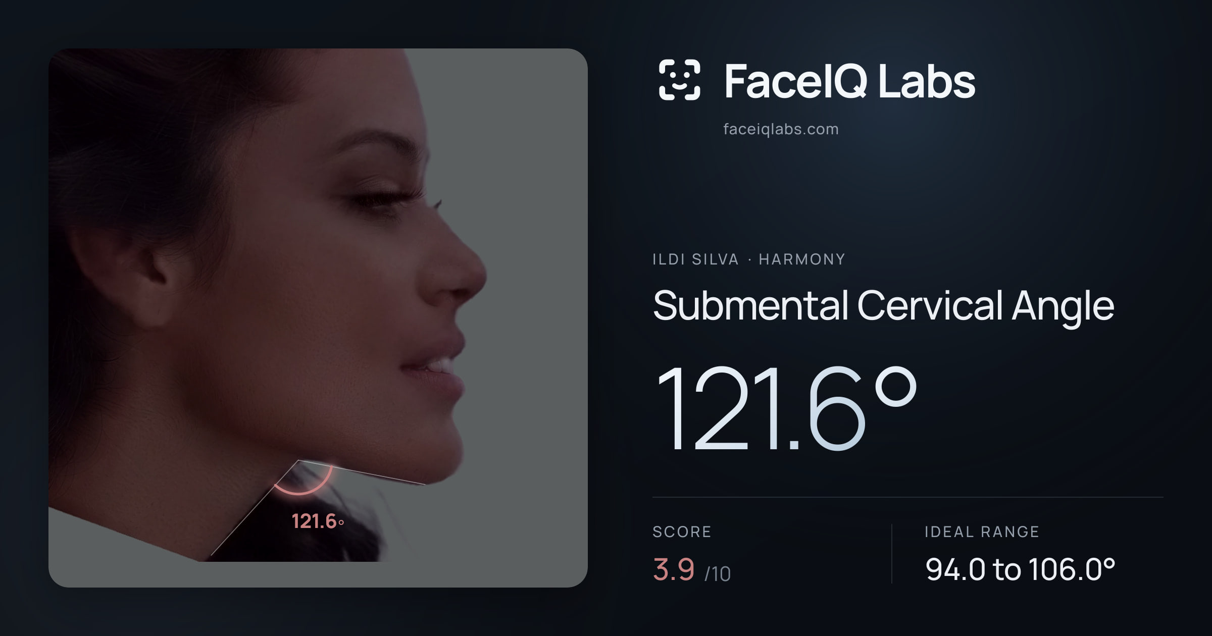 Ildi Silva Submental Cervical Angle: 121.6°, drawn on the photo