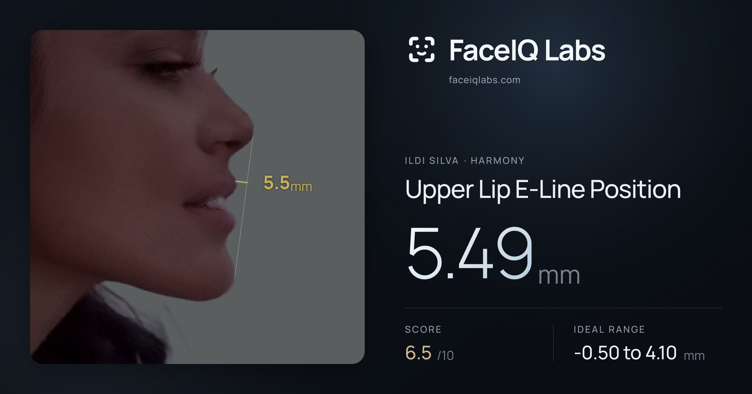 Ildi Silva Upper Lip E-Line Position: 5.49mm, drawn on the photo
