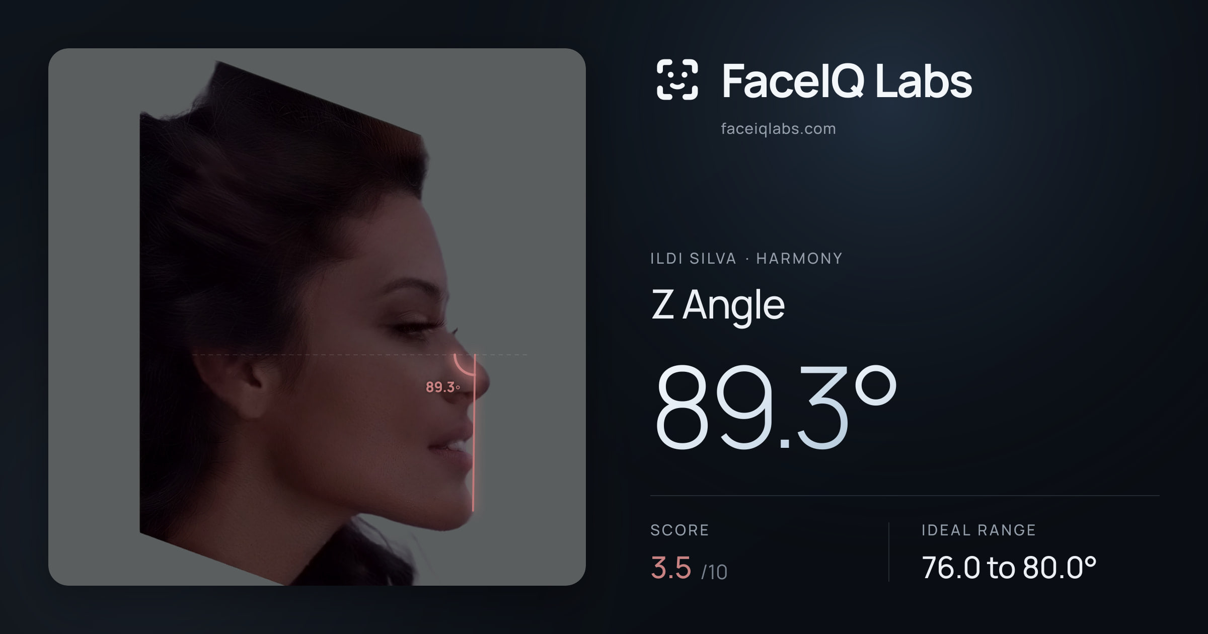 Ildi Silva Z Angle: 89.3°, drawn on the photo