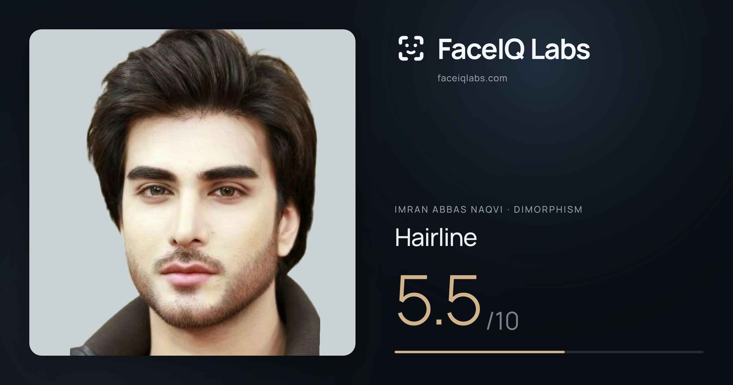 Imran Abbas Naqvi Hairline: 5.5/10, drawn on the photo