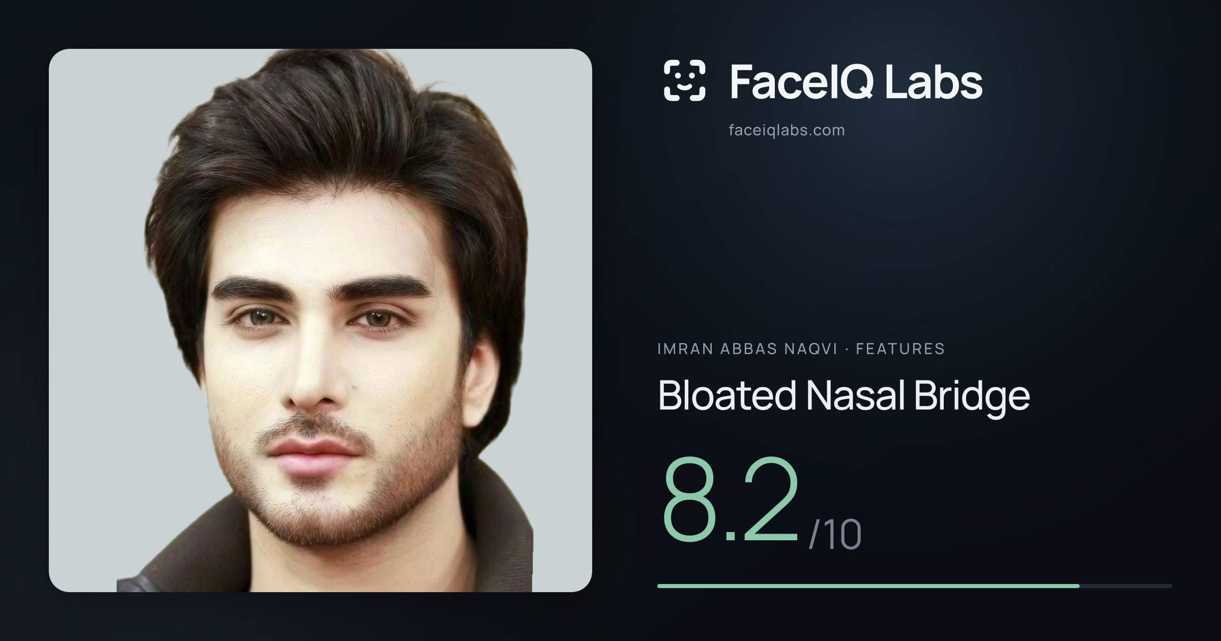 Imran Abbas Naqvi Bloated Nasal Bridge: 8.2/10, drawn on the photo