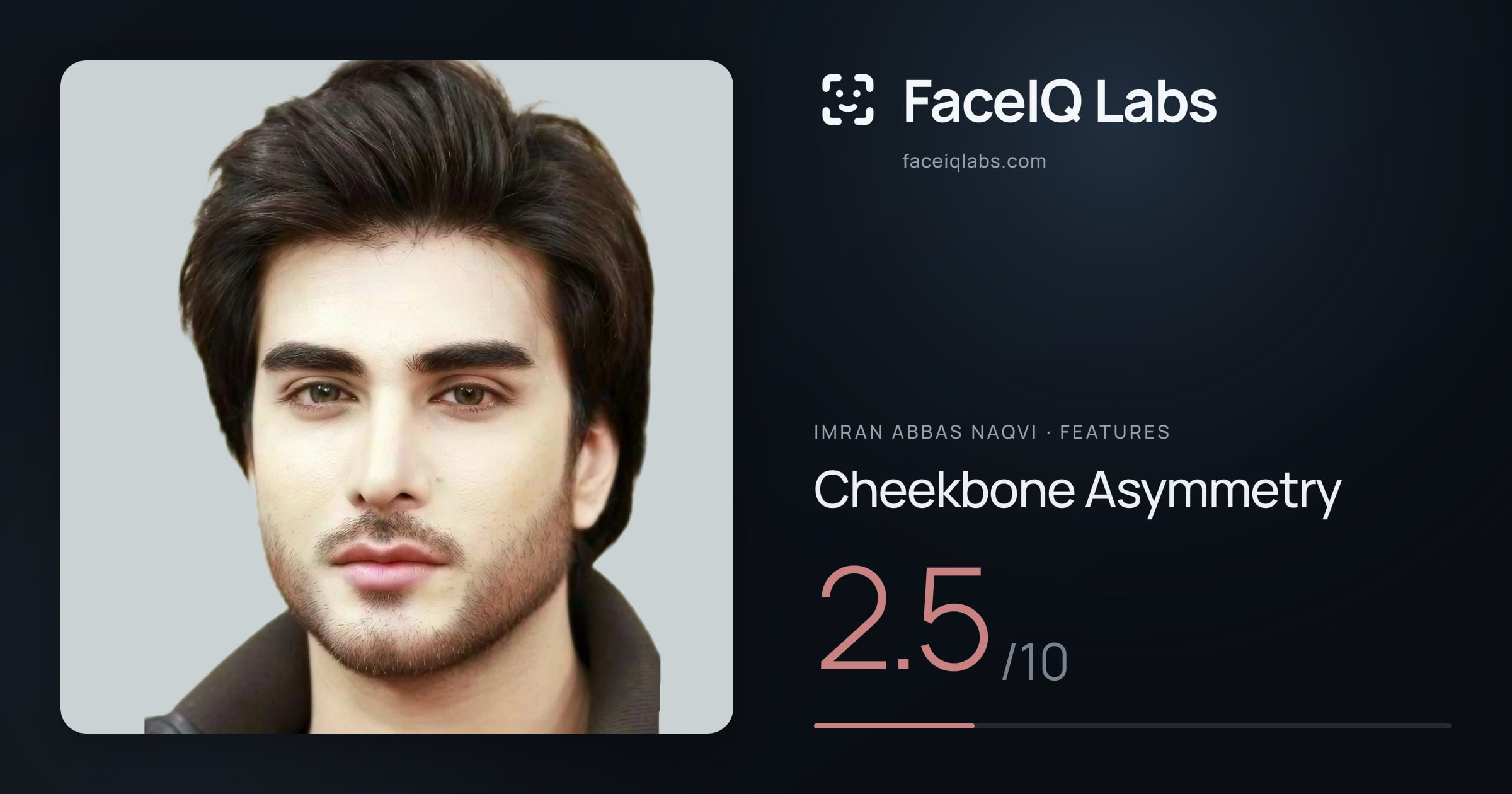 Imran Abbas Naqvi Cheekbone Asymmetry: 2.5/10, drawn on the photo