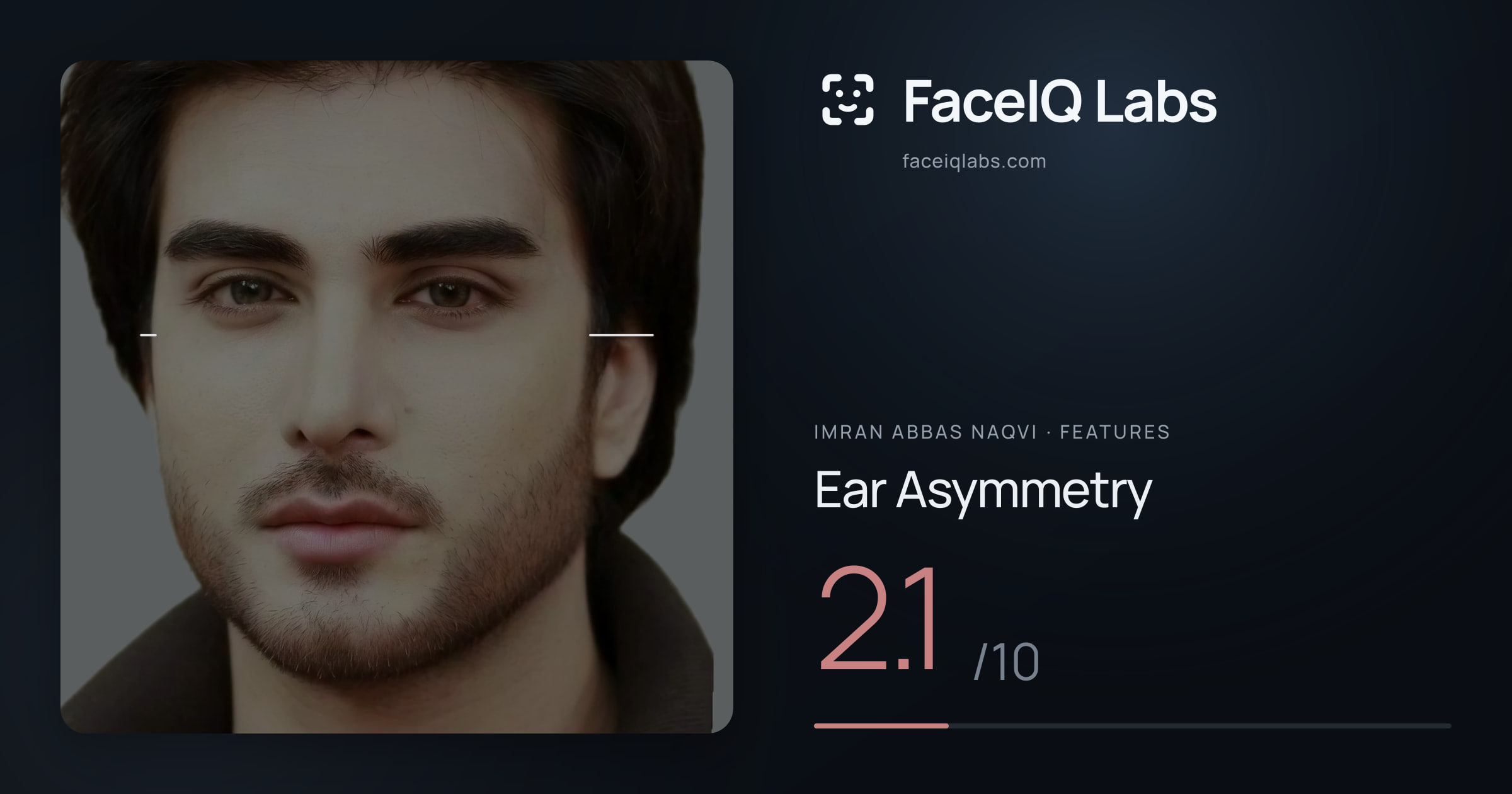Imran Abbas Naqvi Ear Asymmetry: 2.1/10, drawn on the photo