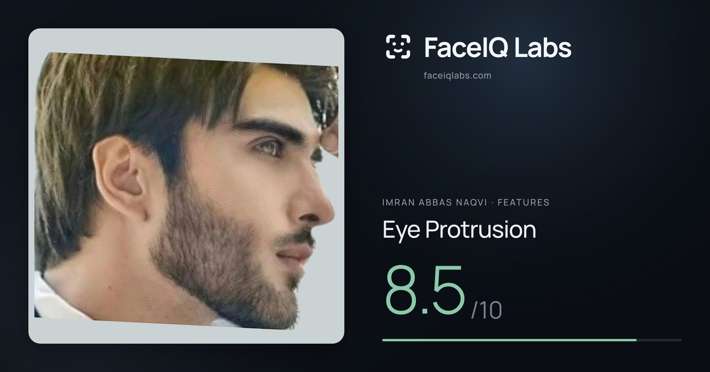 Imran Abbas Naqvi Eye Protrusion: 8.5/10, drawn on the photo
