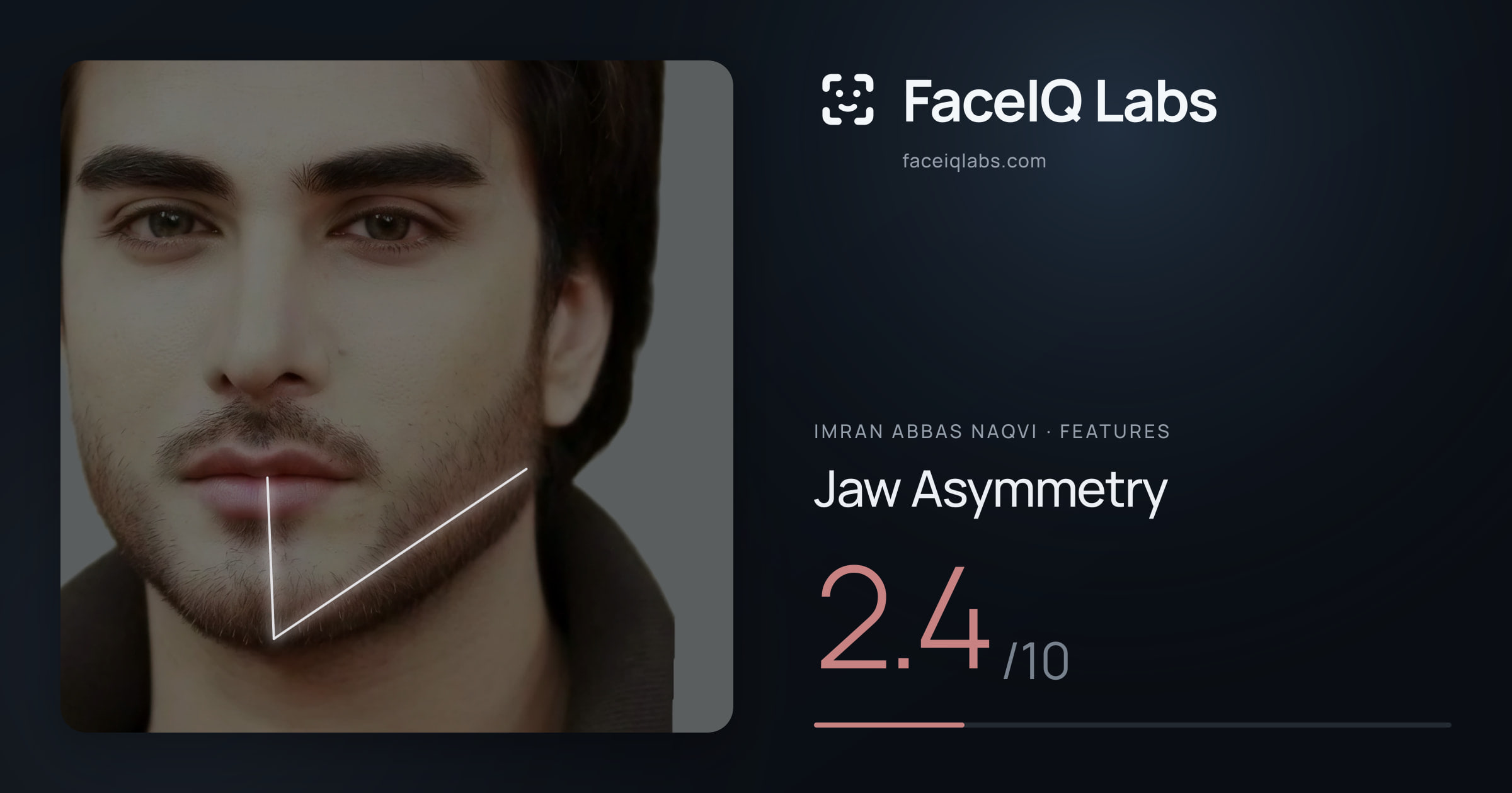 Imran Abbas Naqvi Jaw Asymmetry: 2.4/10, drawn on the photo