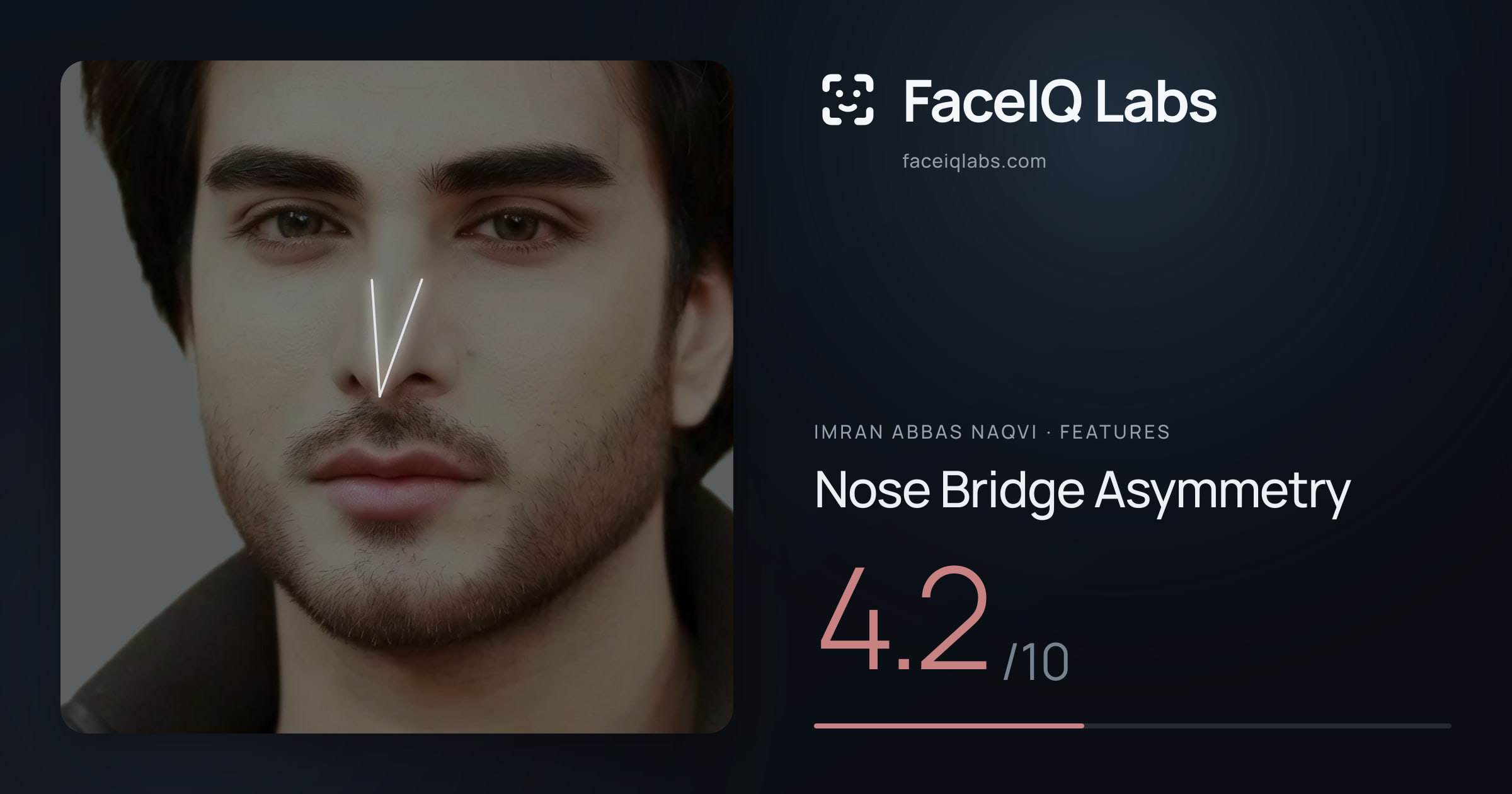 Imran Abbas Naqvi Nose Bridge Asymmetry: 4.2/10, drawn on the photo
