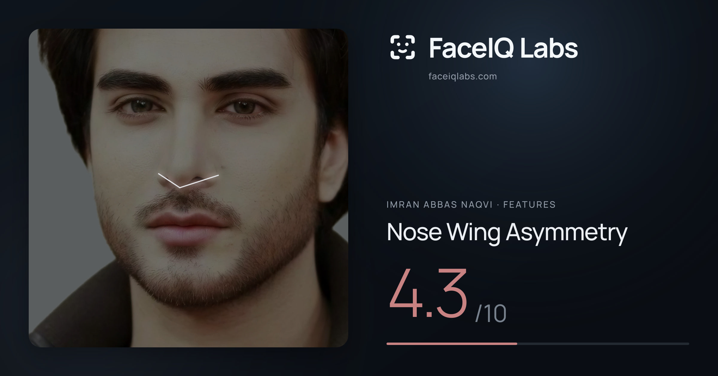 Imran Abbas Naqvi Nose Wing Asymmetry: 4.3/10, drawn on the photo