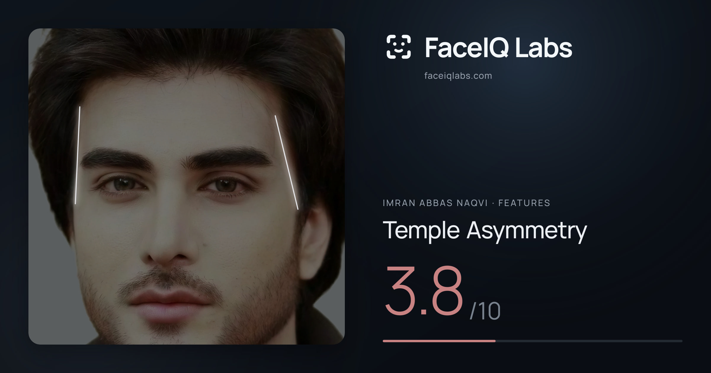 Imran Abbas Naqvi Temple Asymmetry: 3.8/10, drawn on the photo
