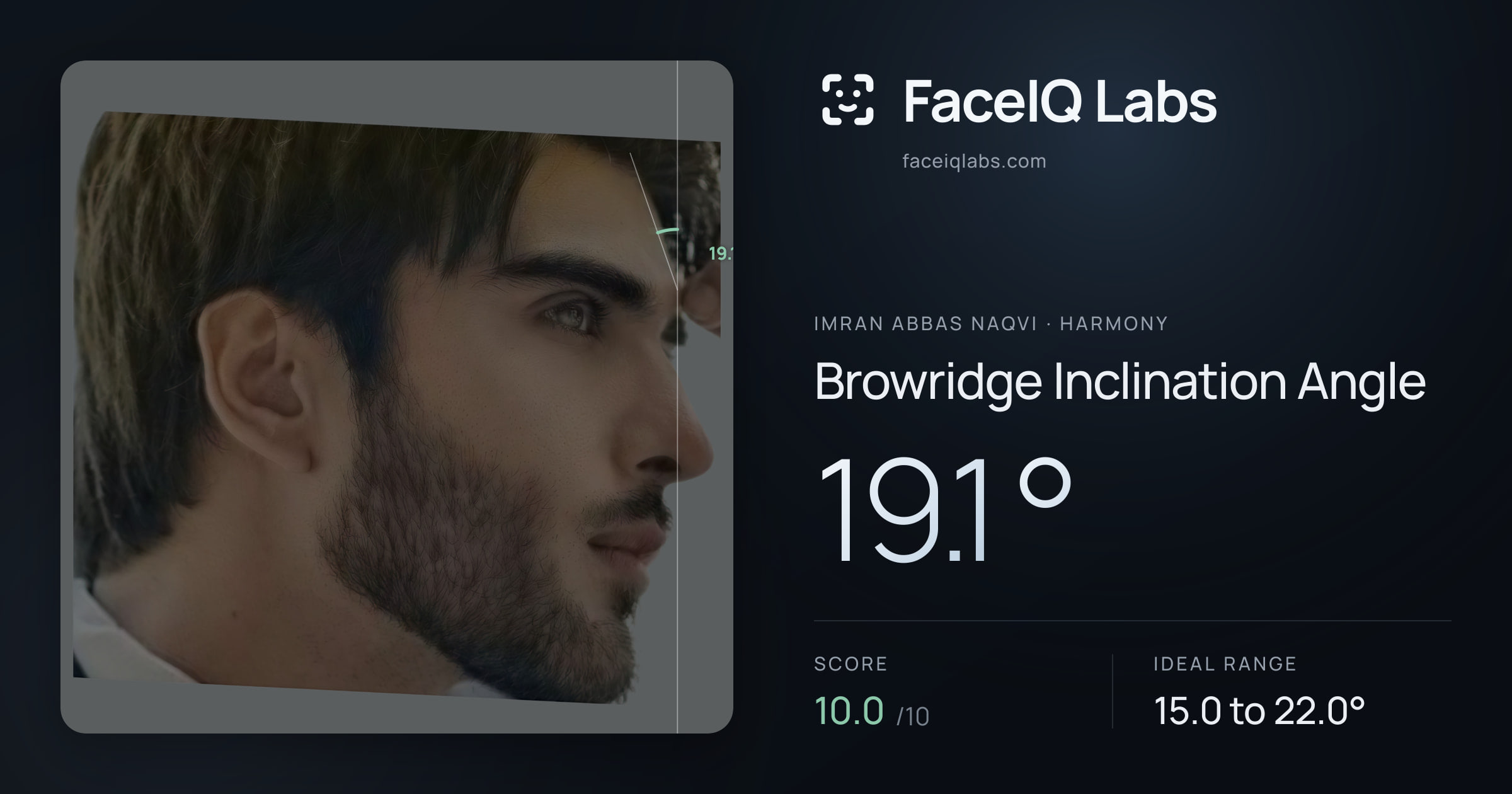 Imran Abbas Naqvi Browridge Inclination Angle: 19.1°, drawn on the photo
