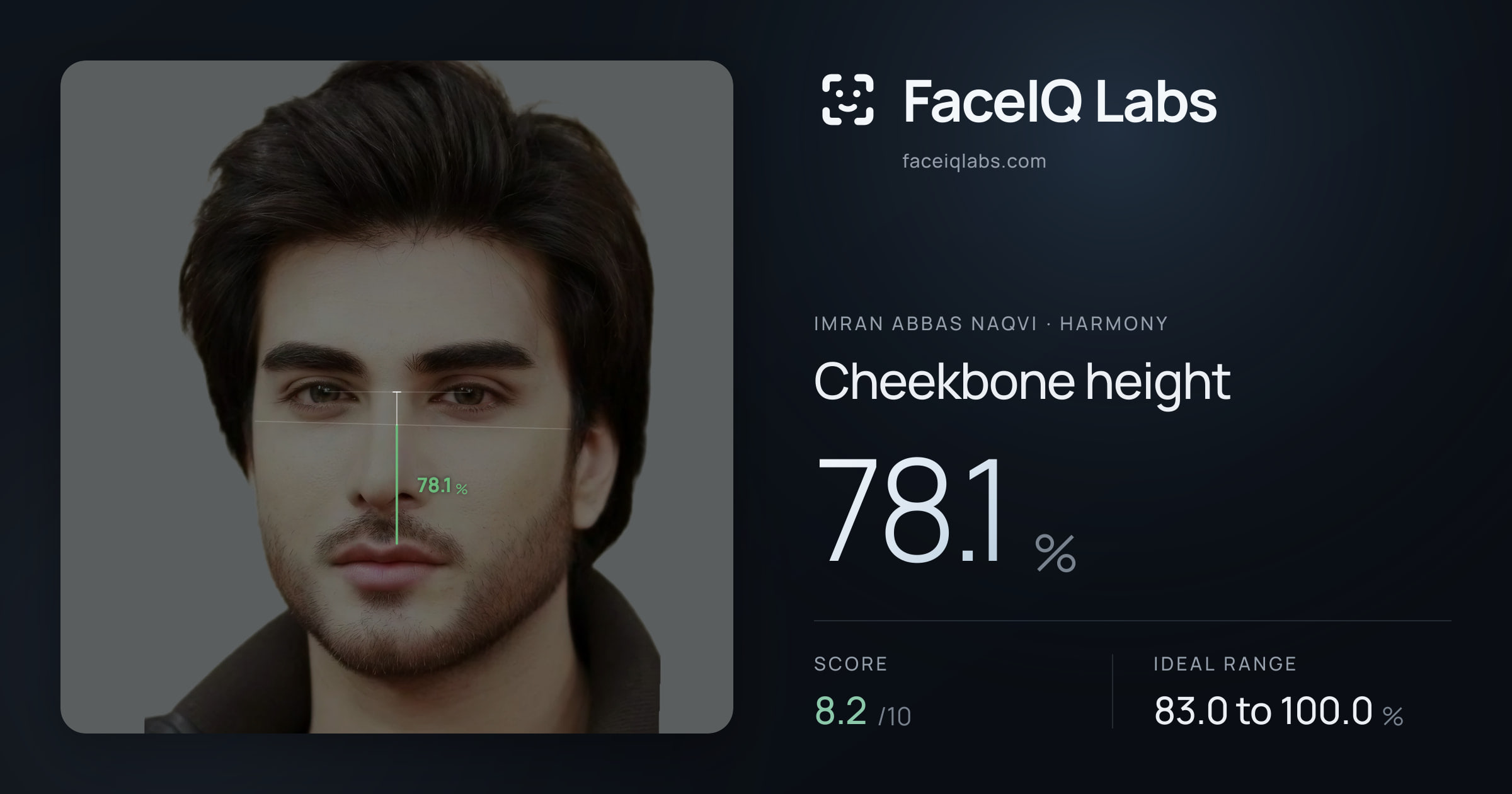Imran Abbas Naqvi Cheekbone height: 78.1%, drawn on the photo