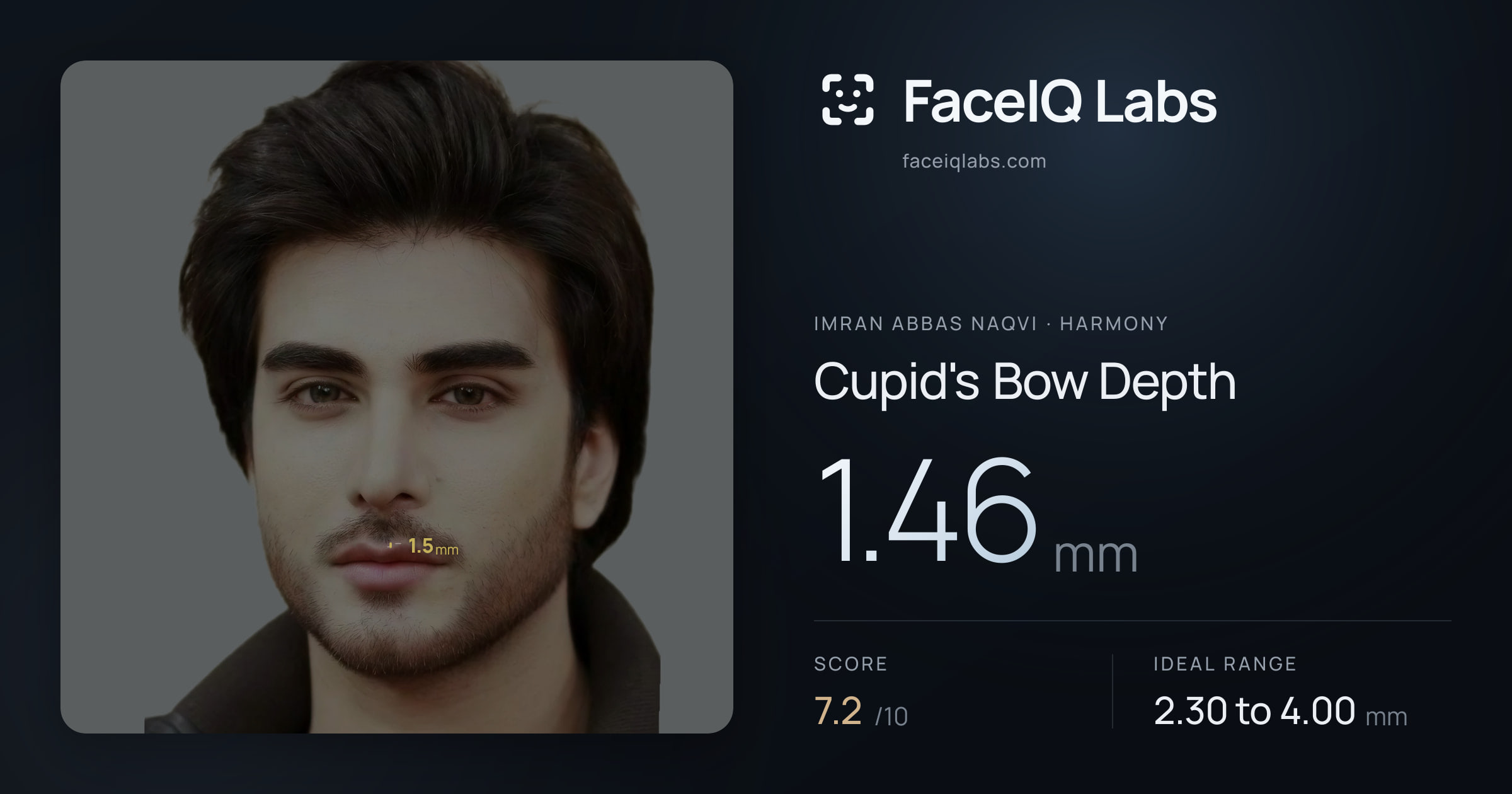 Imran Abbas Naqvi Cupid's Bow Depth: 1.46mm, drawn on the photo
