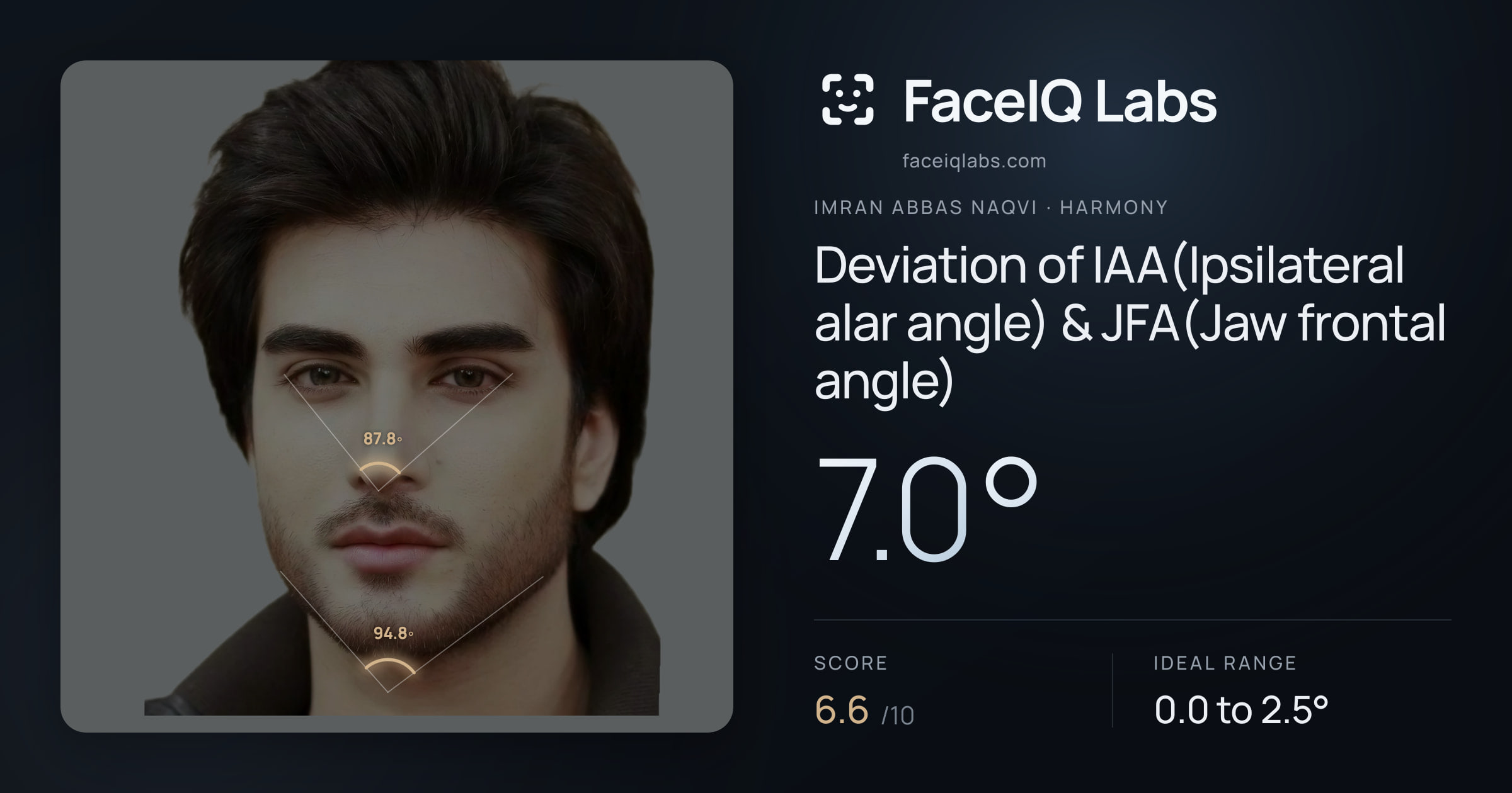 Imran Abbas Naqvi Deviation of IAA(Ipsilateral alar angle) & JFA(Jaw frontal angle): 7.0°, drawn on the photo