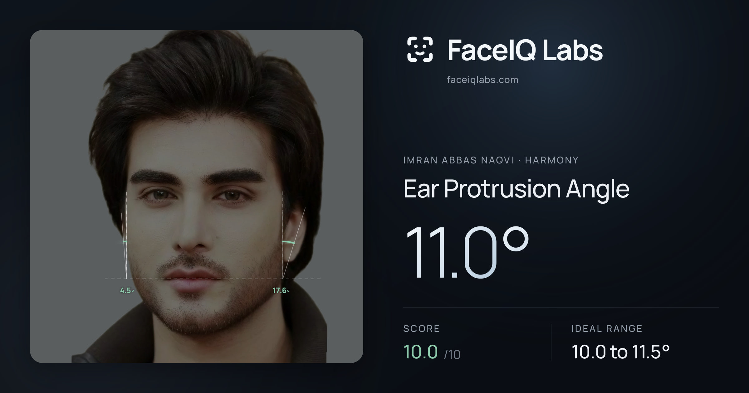 Imran Abbas Naqvi Ear Protrusion Angle: 11.0°, drawn on the photo